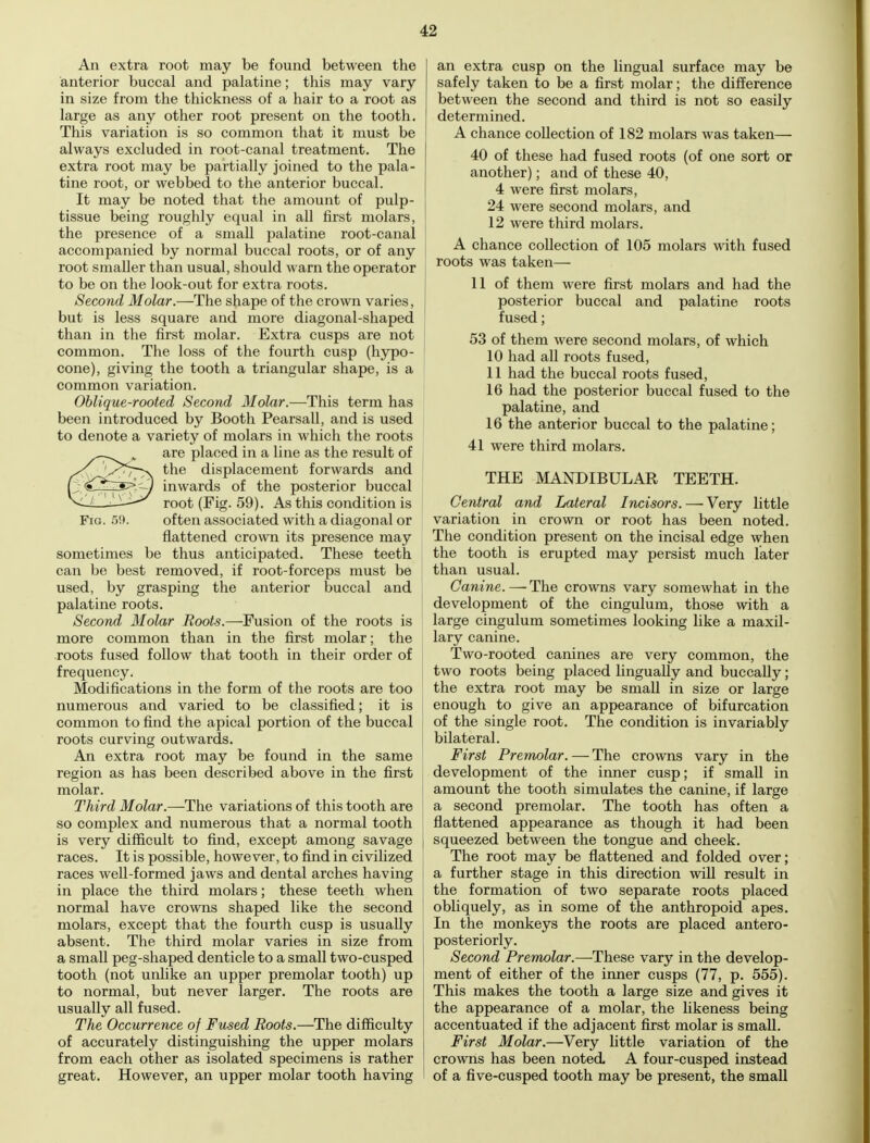 An extra root may be found between the anterior buccal and palatine; this may vary in size from the thickness of a hair to a root as large as any other root present on the tooth. This variation is so common that it must be always excluded in root-canal treatment. The extra root may be partially joined to the pala- tine root, or webbed to the anterior buccal. It may be noted that the amount of pulp- tissue being roughly equal in all first molars, the presence of a small palatine root-canal accompanied by normal buccal roots, or of any root smaller than usual, should warn the operator to be on the look-out for extra roots. Second Molar.—The shape of the crown varies, but is less square and more diagonal-shaped than in the first molar. Extra cusps are not common. The loss of the fourth cusp (hypo- cone), giving the tooth a triangular shape, is a common variation. Oblique-rooted Second Molar.—This term has been introduced by Booth Pearsall, and is used to denote a variety of molars in which the roots „ are placed in a line as the result of / '/^fs. the displacement forwards and ( <£~*~~*s>. J inwards of the posterior buccal ^lA2^—^* root (Fig. 59). As this condition is Fig. 59. often associated with a diagonal or flattened crown its presence may sometimes be thus anticipated. These teeth can be best removed, if root-forceps must be used, by grasping the anterior buccal and palatine roots. Second Molar Roots.—Fusion of the roots is more common than in the first molar; the roots fused follow that tooth in their order of frequency. Modifications in the form of the roots are too numerous and varied to be classified; it is common to find the apical portion of the buccal roots curving outwards. An extra root may be found in the same region as has been described above in the first molar. Third Molar.—The variations of this tooth are so complex and numerous that a normal tooth is very difficult to find, except among savage races. It is possible, however, to find in civilized races well-formed jaws and dental arches having in place the third molars; these teeth when normal have crowns shaped like the second molars, except that the fourth cusp is usually absent. The third molar varies in size from a small peg-shaped denticle to a small two-cusped tooth (not unlike an upper premolar tooth) up to normal, but never larger. The roots are usually all fused. The Occurrence of Fused Roots.—The difficulty of accurately distinguishing the upper molars from each other as isolated specimens is rather great. However, an upper molar tooth having an extra cusp on the lingual surface may be safely taken to be a first molar; the difference between the second and third is not so easily determined. A chance collection of 182 molars was taken— 40 of these had fused roots (of one sort or another); and of these 40, 4 were first molars, 24 were second molars, and 12 were third molars. A chance collection of 105 molars with fused roots was taken— 11 of them were first molars and had the posterior buccal and palatine roots fused; 53 of them were second molars, of which 10 had all roots fused, 11 had the buccal roots fused, 16 had the posterior buccal fused to the palatine, and 16 the anterior buccal to the palatine; 41 were third molars. THE MANDIBULAR TEETH. Central and Lateral Incisors. — Very little variation in crown or root has been noted. The condition present on the incisal edge when the tooth is erupted may persist much later than usual. Canine. — The crowns vary somewhat in the development of the cingulum, those with a large cingulum sometimes looking like a maxil- lary canine. Two-rooted canines are very common, the two roots being placed lingually and buccally; the extra root may be small in size or large j enough to give an appearance of bifurcation I of the single root. The condition is invariably bilateral. First Premolar. — The crowns vary in the development of the inner cusp; if small in | amount the tooth simulates the canine, if large a second premolar. The tooth has often a flattened appearance as though it had been I squeezed between the tongue and cheek. The root may be flattened and folded over; a further stage in this direction will result in the formation of two separate roots placed obliquely, as in some of the anthropoid apes. In the monkeys the roots are placed antero- posteriorly. Second Premolar.—-These vary in the develop- ment of either of the inner cusps (77, p. 555). This makes the tooth a large size and gives it the appearance of a molar, the likeness being accentuated if the adjacent first molar is small. First Molar.—Very little variation of the crowns has been noted A four-cusped instead of a five-cusped tooth may be present, the small