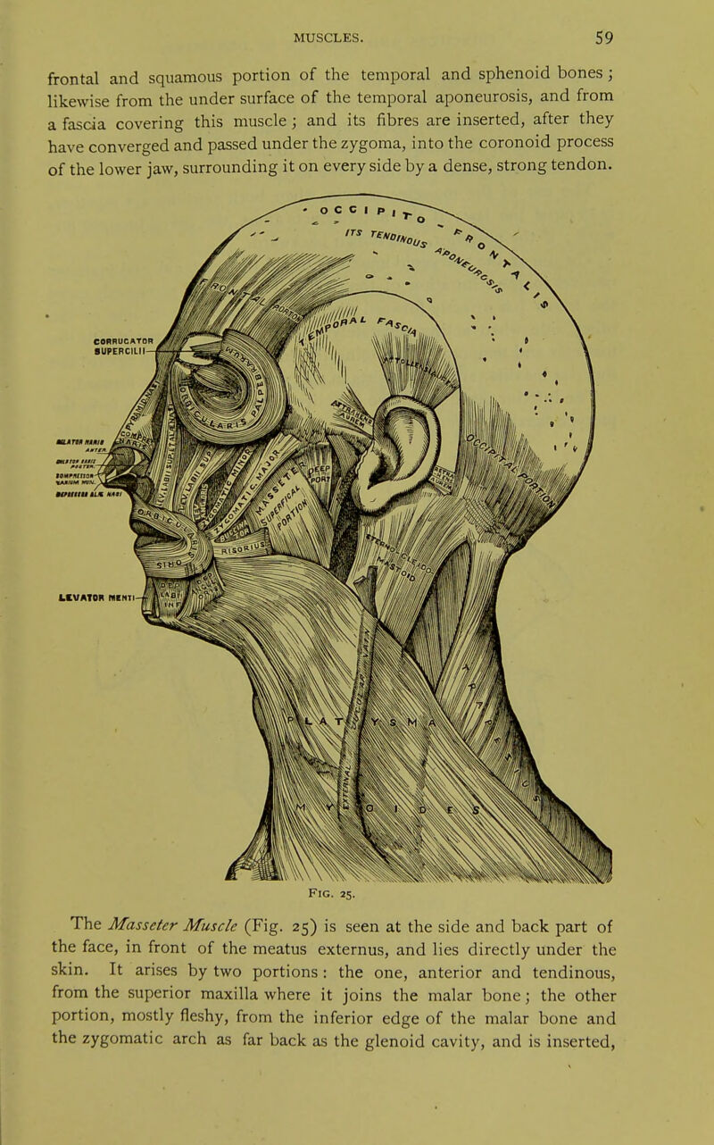 frontal and squamous portion of the temporal and sphenoid bones ; likewise from the under surface of the temporal aponeurosis, and from a fascia covering this muscle ; and its fibres are inserted, after they have converged and passed under the zygoma, into the coronoid process of the lower jaw, surrounding it on every side by a dense, strong tendon. Fig. 25. The Masseter Muscle (Fig. 25) is seen at the side and back part of the face, in front of the meatus externus, and lies directly under the skin. It arises by two portions : the one, anterior and tendinous, from the superior maxilla where it joins the malar bone; the other portion, mostly fleshy, from the inferior edge of the malar bone and the zygomatic arch as far back as the glenoid cavity, and is inserted,