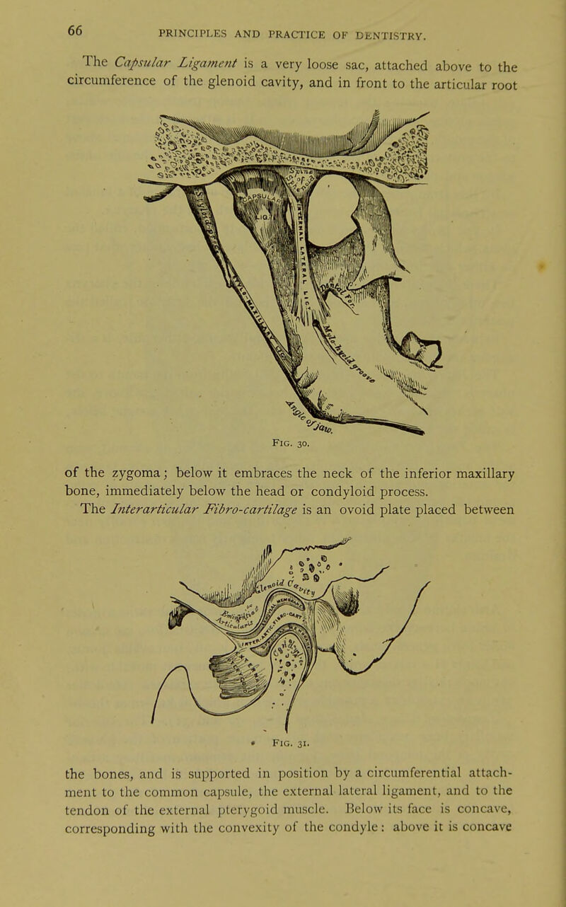 The Capsular Ligament is a very loose sac, attached above to the circumference of the glenoid cavity, and in front to the articular root Fig. 30. of the zygoma; below it embraces the neck of the inferior maxillary bone, immediately below the head or condyloid process. The Interarticular Fibro-cartilage is an ovoid plate placed between • Fig. 31. the bones, and is supported in position by a circumferential attach- ment to the common capsule, the external lateral ligament, and to the tendon of the external pterygoid muscle. Below its face is concave, corresponding with the convexity of the condyle: above it is concave