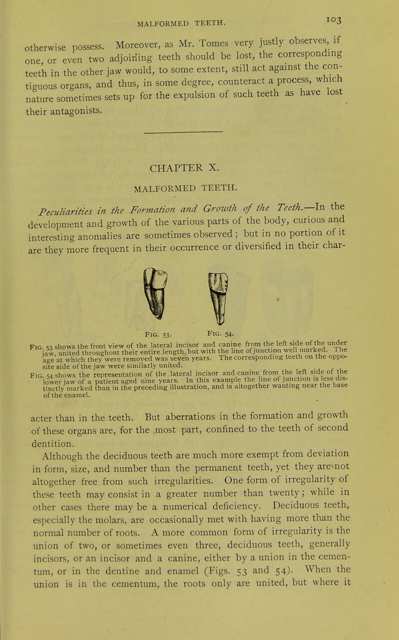 Otherwise possess. Moreover, as Mr. Tomes very justly observes, if one or even two adjoining teeth should be lost, the corresponding teeth in the other jaw would, to some extent, still act against the con- tiguous organs, and thus, in some degree, counteract a process, which nature sometimes sets up for the expulsion of such teeth as have lost their antagonists. CHAPTER X. MALFORMED TEETH. Peculiarities in the Formation and Growth of the Teeth.—In the development and growth of the various parts of the body, curious and interesting anomalies are sometimes observed ; but in no portion of it are they more frequent in their occurrence or diversified in their char- FlG. 53- 54- Fig shows the front view of the lateral incisor and canine from the left side of the under jaw, united throughout their entire length, but with the line of junction wel marked. The age at which they were removed was seven years. The corresponding teeth on the oppo- site side of the jaw were similarly united. Fig. s4 shows the representation of the lateral incisor and canine from the left side of the lower jaw of a patient aged nine years. In this example the line of junction is less dis- tinctly marked than in the preceding illustration, and is altogether wanting near the base of the enamel. acter than in the.teeth. But aberrations in the formation and growth of these organs are, for the .most part, confined to the teeth of second dentition. Although the deciduous teeth are much more exempt from deviation in form, size, and number than the permanent teeth, yet they aremot altogether free from such irregularities. One form of irregularity of these teeth may consist in a greater number than twenty; while in other cases there may be a numerical deficiency. Deciduous teeth, especially the molars, are occasionally met with having more than the normal number of roots. A more common form of irregularity is the union of two, or sometimes even three, deciduous teeth, generally incisors, or an incisor and a canine, either by a union in the cemen- tum, or in the dentine and enamel (Figs. 53 and 54)- When the union is in the cementum, the roots only are united, but where it