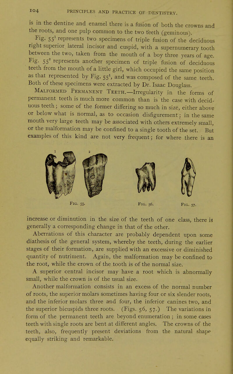 is in the dentine and enamel there is a fusion of both the crowns and the roots, and one pulp common to the two teeth (geminous). Fig. represents two specimens of triple fusion of the deciduous right superior lateral incisor and cuspid, with a supernumerary tooth between the two, taken from the mouth of a boy three years of age. Fig. 55^ represents another specimen of triple fusion of deciduous teeth from the mouth of a little girl, which occupied the same position as that represented by Fig. 55S and was composed of the same teeth. Both of these specimens were extracted by Dr. Isaac Douglass. Malformed Permanent Teeth.—Irregularity in the forms of permanent teeth is much more common than is the case with decid- uous teeth; some of the former differing so much in size, either above or below what is normal, as to occasion disfigurement; in the same mouth very large teeth may be associated with others extremely small, or the malformation may be confined to a single tooth of the set. But examples of this kind are not very frequent; for where there is an Fig. 55. Fig. 56. Fig. 57. increase or diminution in the size of the teeth of one class, there is generally a corresponding change in that of the other. Aberrations of this character are probably dependent upon some diathesis of the general system, whereby the teeth, during the earlier stages of their formation, are supplied with an excessive or diminished quantity of nutriment. Again, the malformation may be confined to the root, while the crown of the tooth is of the normal size. A superior central incisor may have a root which is abnormally small, while the crown is of the usual size. Another malformation consists in an excess of the normal number of roots, the superior molars sometimes having four or six slender roots, and the inferior molars three amd four, the inferior canines two, and the superior bicuspids three roots. (Figs. 56, 57.) The variations in form of the permanent teeth are beyond enumeration ; in some cases teeth with single roots are bent.at different angles. The crowns of the teeth, also, frequently present deviations from the natural shape equally striking and remarkable.