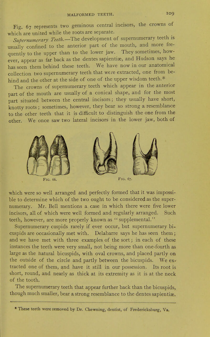 Fig. 67 represents two geminous central incisors, the crowns of which are united while the roots are separate. Supernumerary Teeth.—ThQ development of supernumerary teeth is usually confined to the anterior part of the mouth, and more fre- quently to the upper than to the lower jaw. They sometimes, how- ever, appear as far back as the dentes sapientias, and Hudson says he has seen them behind these teeth. We have now in our anatomical collection two supernumerary teeth that were extracted, one from be- hind and the other at the side of one of the upper wisdom teeth.* The crowns of supernumerary teeth which appear in the anterior part of the mouth are usually of a conical shape, and for the most part situated between the central incisors; they usually have short, knotty roots ; sometimes, however, they bear so strong a resemblance to the other teeth that it is difficult to distinguish the one from the other. We once saw two lateral incisors in the lower jaw, both of which were so well arranged and perfectly formed that it was impossi- ble to determine which of the two ought to be considered as the super- numerary. Mr. Bell mentions a case in which there were five lower incisors, all of which were well formed and regularly arranged. Such teeth, however, are more properly known as  supplemental. Supernumerary cuspids rarely if ever occur, but supernumerary bi- cuspids are occasionally met with. Delabarre says he has seen them; and we have met with three examples of the sort; in each of these instances the teeth were very small, not being more than one-fourth as large as the natural bicuspids, with oval crowns, and placed partly on the outside of the circle and partly between the bicuspids. We ex- tracted one of them, and have it still in our possession. Its root is short, round, and nearly as thick at its extremity as it is at the neck of the tooth. The supernumerary teeth that appear further back than the bicuspids, though much smaller, bear a strong resemblance to the dentes sapientise. * These teeth were removed by Dr. Chewning, dentist, of Fredericksburg, Va.