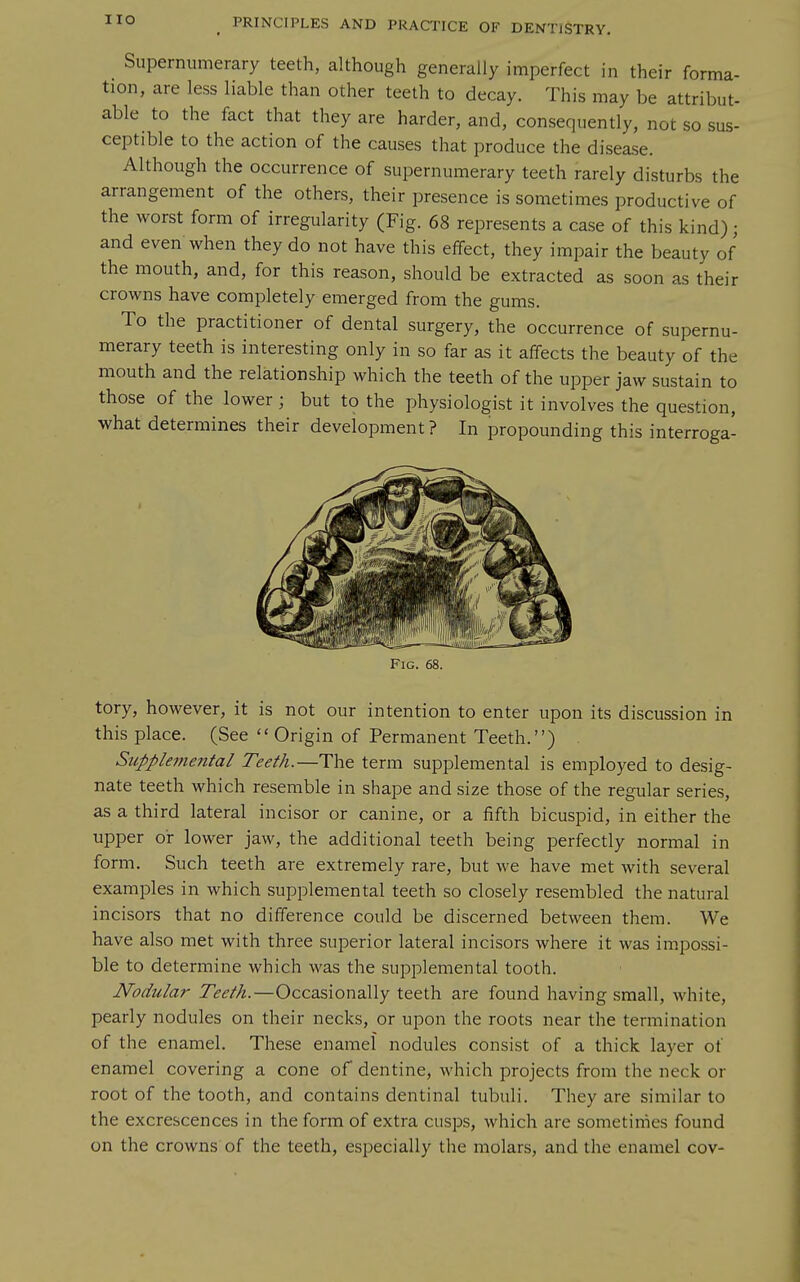 Supernumerary teeth, although generally imperfect in their forma- tion, are less liable than other teeth to decay. This may be attribut- able to the fact that they are harder, and, consequently, not so sus- ceptible to the action of the causes that produce the disease. Although the occurrence of supernumerary teeth rarely disturbs the arrangement of the others, their presence is sometimes productive of the worst form of irregularity (Fig. 68 represents a case of this kind); and even when they do not have this effect, they impair the beauty of the mouth, and, for this reason, should be extracted as soon as their crowns have completely emerged from the gums. To the practitioner of dental surgery, the occurrence of supernu- merary teeth is interesting only in so far as it affects the beauty of the mouth and the relationship which the teeth of the upper jaw sustain to those of the lower ; but to the physiologist it involves the question, what determines their development? In propounding this interroga- FiG. 68. tory, however, it is not our intention to enter upon its discussion in this place. (See  Origin of Permanent Teeth.) . Supple7Jiental Teeth.—The term supplemental is employed to desig- nate teeth which resemble in shape and size those of the regular series, as a third lateral incisor or canine, or a fifth bicuspid, in either the upper or lower jaw, the additional teeth being perfectly normal in form. Such teeth are extremely rare, but we have met with several examples in which supplemental teeth so closely resembled the natural incisors that no difference could be discerned between them. We have also met with three superior lateral incisors where it was impossi- ble to determine which was the supplemental tooth. Nodular Teeth.—Occasionally teeth are found having small, white, pearly nodules on their necks, or upon the roots near the termination of the enamel. These enamel nodules consist of a thick layer of enamel covering a cone of dentine, which projects from the neck or root of the tooth, and contains dentinal tubuli. They are similar to the excrescences in the form of extra cusps, which are sometimes found on the crowns of the teeth, especially the molars, and the enamel cov-