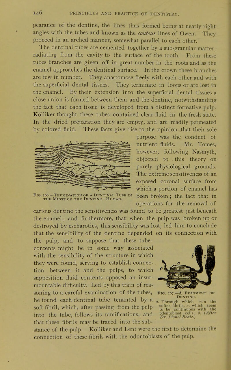 pearance of the dentine, the lines thus formed being at nearly right angles with the tubes and known as the contour lines of Owen. They proceed in an arched manner, somewhat parallel to each other. The dentinal tubes are cemented together by a sub-granular matter, radiating from the cavity to the surface of the tooth. From these tubes branches are given off in great number in the roots and as the enamel approaches the dentinal surface. In the crown these branches are few in number. They anastomose freely with each other and with the superficial dental tissues. They terminate in loops or are lost in the enamel. By their extension into the superficial dental tissues a close union is formed between them and the dentine, notwithstanding the fact that each tissue is developed from a distinct formative pulp. Kolliker thought these tubes contained clear fluid in the fresh state. In the dried preparation they are empty, and are readily permeated by colored fluid. These facts give rise to the opinion that their sole purpose was the conduct of ^'^*-^=^^=^^^^=^^ nutrient fluids. Mr. Tomes, however, following Nasmyth, objected to this theory on purely physiological grounds. The extreme sensitiveness of an exposed coronal surface from which a portion of enamel has Fig. 106.-TERMINAT10N OF A Dentinal Tube in ^een broken : the fact that in THE Midst of the Dentine—Human. ' operations for the removal of carious dentine the sensitiveness was found to be greatest just beneath the enamel; and furthermore, that when the pulp was broken up or destroyed by escharotics, this sensibility was lost, led him to conclude that the sensibility of the dentine depended on its connection with the pulp, and to suppose that these tube- contents might be in some way associated with the sensibility of the structure in which they were found, serving to establish connec- tion between it and the pulps, to which supposition fluid contents opposed an insur- mountable difficulty. Led by this train of rea- soning to a careful examination of the tubes, he found each dentinal tube tenanted by a soft fibril, which, after passing from the pulp into the tube, follows its ramifications, and that these fibrils may be traced into the sub- stance of the pulp. Kolliker and Lent were the first to determine the connection of these fibrils with the odontoblasts of the pulp. Fig. OF 107.—A Fragment Dentine. a. Through which run the softer fuirils, r, which seem to he continuous with the ociontohlasl cells, {After Dr. Lionel Beale.)