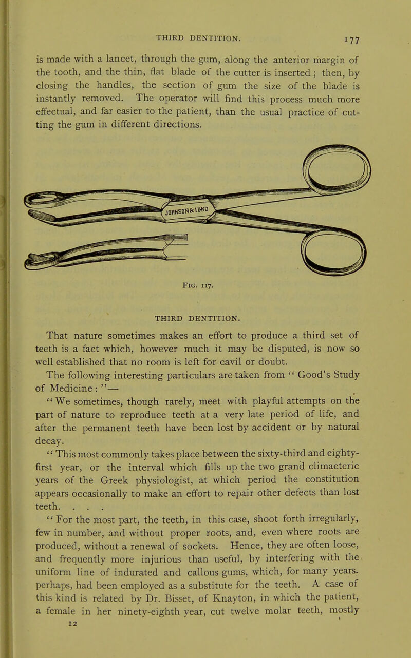 is made with a lancet, through the gum, along the anterior margin of the tooth, and the thin, flat blade of the cutter is inserted; then, by- closing the handles, the section of gum the size of the blade is instantly removed. The operator will find this process much more effectual, and far easier to the patient, than the usual practice of cut- ting the gum in different directions. Fig. 117. THIRD DENTITION. That nature sometimes makes an effort to produce a third set of teeth is a fact which, however much it may be disputed, is now so well established that no room is left for cavil or doubt. The following interesting particulars are taken from  Good's Study of Medicine : — We sometimes, though rarely, meet with playful attempts on the part of nature to reproduce teeth at a very late period of life, and after the permanent teeth have been lost by accident or by natural decay.  This most commonly takes place between the sixty-third and eighty- first year, or the interval which fills up the two grand climacteric years of the Greek physiologist, at which period the constitution appears occasionally to make an effort to repair other defects than lost teeth.  For the most part, the teeth, in this case, shoot forth irregularly, few in number, and without proper roots, and, even where roots are produced, without a renewal of sockets. Hence, they are often loose, and frequently more injurious than useful, by interfering with the uniform line of indurated and callous gums, which, for many years, perhaps, had been employed as a substitute for the teeth. A case of this kind is related by Dr. Bisset, of Knayton, in which the patient, a female in her ninety-eighth year, cut twelve molar teeth, mostly