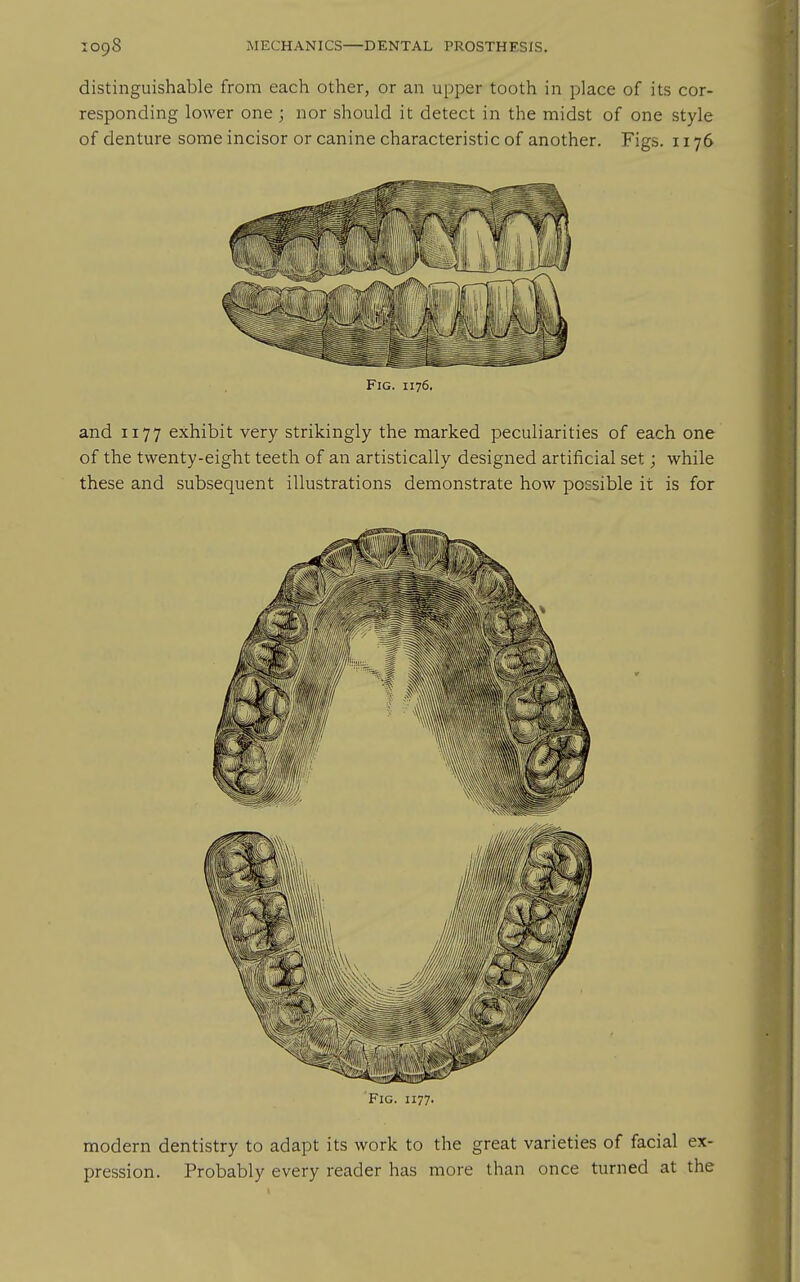 distinguishable from each other, or an upper tooth in place of its cor- responding lower one ; nor should it detect in the midst of one style of denture some incisor or canine characteristic of another. Figs. 1176 Fig. I176. and 1177 exhibit very strikingly the marked peculiarities of each one of the twenty-eight teeth of an artistically designed artificial set; while these and subsequent illustrations demonstrate how possible it is for Fig. 1177. modern dentistry to adapt its work to the great varieties of facial ex- pression. Probably every reader has more than once turned at the
