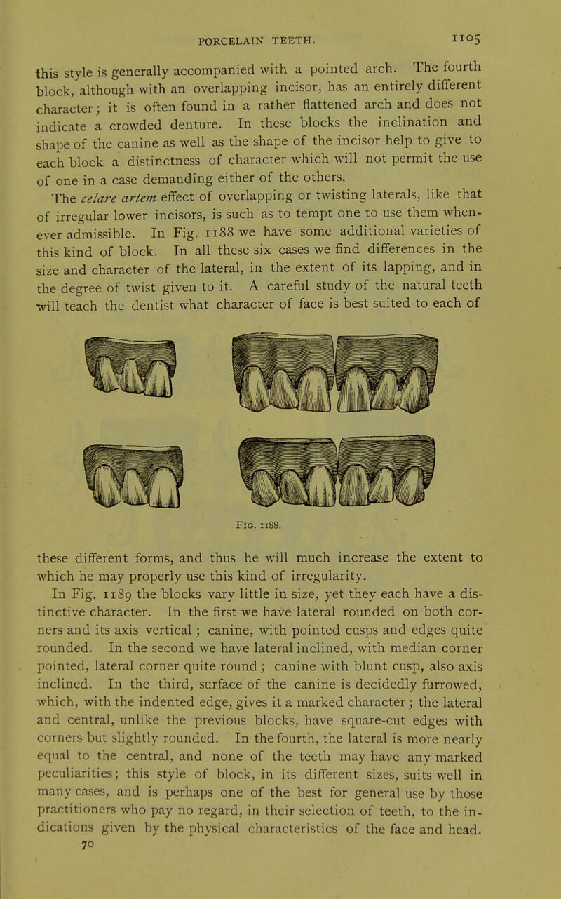 this Style is generally accompanied with a pointed arch. The fourth block, although with an overlapping incisor, has an entirely different character; it is often found in a rather flattened arch and does not indicate a crowded denture. In these blocks the inclination and shape of the canine as well as the shape of the incisor help to give to each block a distinctness of character which will not permit the use of one in a case demanding either of the others. The celare artem effect of overlapping or twisting laterals, like that of irregular lower incisors, is such as to tempt one to use them when- ever admissible. In Fig. 1188 we have some additional varieties of this kind of block. In all these six cases we find differences in the size and character of the lateral, in the extent of its lapping, and in the degree of twist given to it. A careful study of the natural teeth ■will teach the dentist what character of face is best suited to each of Fig. ii88. these different forms, and thus he will much increase the extent to which he may properly use this kind of irregularity. In Fig. 1189 the blocks vary little in size, yet they each have a dis- tinctive character. In the first we have lateral rounded on both cor- ners and its axis vertical; canine, with pointed cusps and edges quite rounded. In the second we have lateral inclined, with median corner pointed, lateral corner quite round; canine with blunt cusp, also axis inclined. In the third, surface of the canine is decidedly furrowed, which, with the indented edge, gives it a marked character; the lateral and central, unlike the previous blocks, have square-cut edges with corners but slightly rounded. In the fourth, the lateral is more nearly equal to the central, and none of the teeth may have any marked peculiarities; this style of block, in its different sizes, suits well in many cases, and is perhaps one of the best for general use by those practitioners who pay no regard, in their selection of teeth, to the in- dications given by the physical characteristics of the face and head. 70