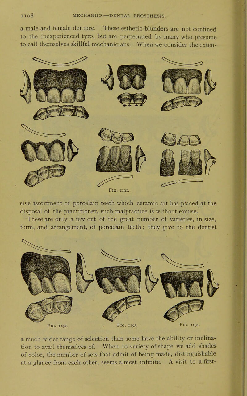 a male and female denture. These esthetic blunders are not confined to the inexperienced tyro, but are perpetrated by many who presume to call themselves skillful mechanicians. When we consider the exten- FlG. 1191. sive assortment of porcelain teeth which ceramic art has placed at the disposal of the practitioner, such malpractice is without excuse. These are only a few out of the great number of varieties, in size, form, and arrangement, of porcelain teeth; they give to the dentist Fig. 1192. - Fig. 1193. Fig. 1194. a much wider range of selection than some have the ability or inclina- tion to avail themselves of. When to variety of shape we add shades of color, the number of sets that admit of being made, distinguishable at a glance from each other, seems almost infinite. A visit to a first-