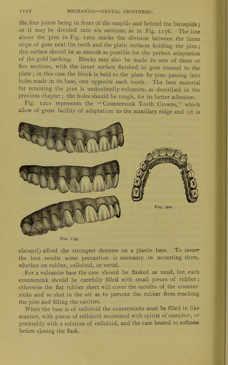 the four joints being in front of the cuspids and behind the bicuspids ; or it maybe divided into six sections, as in Fig. 1176. The line above the'pins in Fig. 1200 marks the division between the inner slope of gum next the teeth and the plain surfaces holding the pins; this surface should be as smooth as possible for the perfect adaptation of the gold backing. Blocks may also be made in sets of three or five sections, with the inner surface finished in gum enamel to the plate J in this case the block is held to the plate by pins passing into holes made in its base, one opposite each tooth. The best material for retaining the pins is undoubtedly vulcanite, as described in the previous chapter; the holes should be rough, for its better adhesion. Fig. 1201 represents the Countersunk Tooth Crowns, which allow of great facility of adaptation to the maxillary ridge and (it is Fig. 1199. claimed) afford the strongest denture on a plastic base. To insure the best results some precaution is necessary ip mounting them, whether on rubber, celluloid, or metal. For a vulcanite base the case should be flasked as usual, but each countersink should be carefully filled with small pieces of rubber; otherwise the flat rubber sheet will cover the mouths of the counter- sinks and so shut in the air as to prevent the rubber from reaching the pins and filling the cavities. When the base is of celluloid the countersinks must be filled in like manner, with pieces of celluloid moistened with spirits of camphor, or preferably with a solution of celluloid, and the case heated to softness before closing the flask.