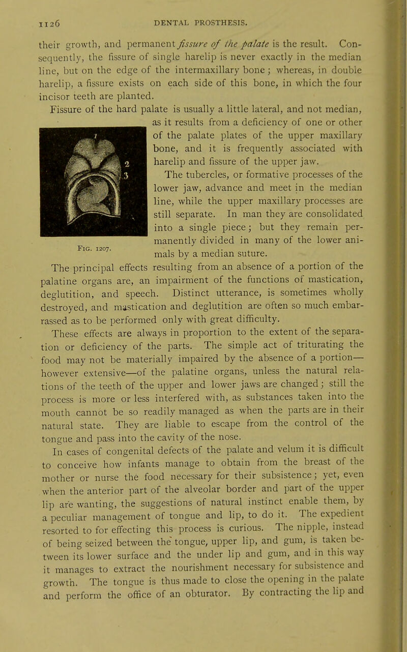 their growth, and permanent fissure of the palate is the result. Con- sequently, the fissure of single harelip is never exactly in the median line, but on the edge of the intermaxillary bone; whereas, in double harelip, a fissure exists on each side of this bone, in which the four incisor teeth are planted. Fissure of the hard palate is usually a little lateral, and not median, as it results from a deficiency of one or other of the palate plates of the upper maxillary bone, and it is frequently associated with harelip and fissure of the upper jaw. The tubercles, or formative processes of the lower jaw, advance and meet in the median line, while the upper maxillary processes are still separate. In man they are consolidated into a single piece; but they remain per- manently divided in many of the lower ani- iG. 1207. xti'^s by a median suture. The principal effects resulting from an absence of a portion of the palatine organs are, an impairment of the functions of mastication, deglutition, and speech. Distinct utterance, is sometimes wholly destroyed, and mastication and deglutition are often so much embar- rassed as to be performed only with great difficulty. These effects are always in proportion to the extent of the separa- tion or deficiency of the parts. The simple act of triturating the food may not be materially impaired by the absence of a portion— however extensive—of the palatine organs, unless the natural rela- tions of the teeth of the upper and lower jaws are changed; still the process is more or less interfered with, as substances taken into the mouth cannot be so readily managed as when the parts are in their natural state. They are liable to escape from the control of the tongue and pass into the cavity of the nose. In cases of congenital defects of the palate and velum it is difficult to conceive how infants manage to obtain from the breast of the mother or nurse the food necessary for their subsistence; yet, even when the anterior part of the alveolar border and part of the upper lip are wanting, the suggestions of natural instinct enable them, by a peculiar management of tongue and lip, to do it. The expedient resorted to for effecting this process is curious. The nipple, instead of being seized between the tongue, upper lip, and gum, is taken be- tween its lower surface and the under lip and gum, and in this way it manages to extract the nourishment necessary for subsistence and growth. The tongue is thus made to close the opening in the palate and perform the office of an obturator. By contracting the lip and