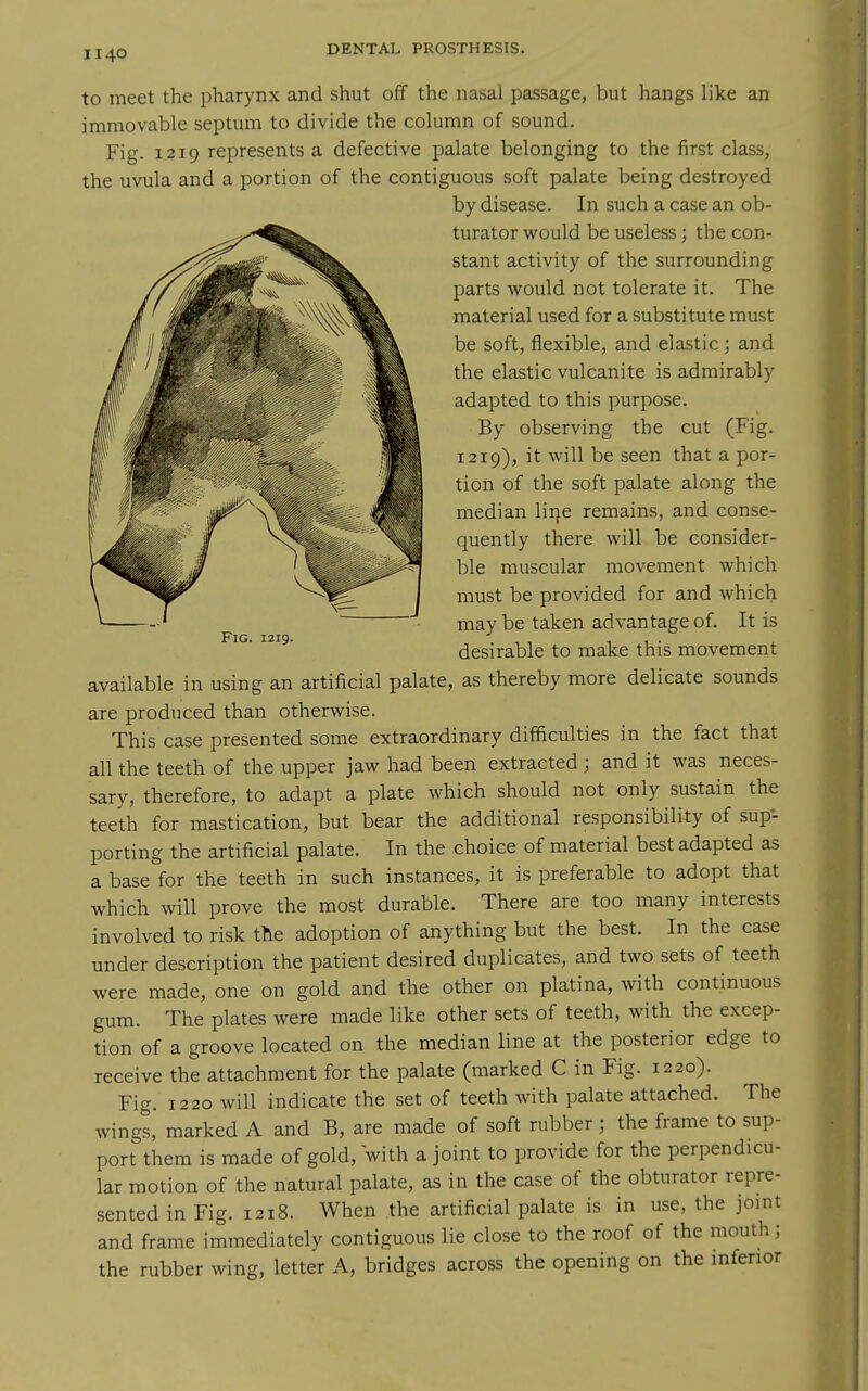 Fig. 1219. to meet the pharynx and shut off the nasal passage, but hangs like an immovable septum to divide the column of sound. Fig. 1219 represents a defective palate belonging to the first class, the uvula and a portion of the contiguous soft palate being destroyed by disease. In such a case an ob- turator would be useless; the con- stant activity of the surrounding parts would not tolerate it. The material used for a substitute must be soft, flexible, and elastic ; and the elastic vulcanite is admirably adapted to this purpose. By observing the cut (Fig. 1219), it will be seen that a por- tion of the soft palate along the median lir}e remains, and conse- quently there will be consider- ble muscular movement which must be provided for and which may be taken advantage of. It is desirable to make this movement available in using an artificial palate, as thereby more delicate sounds are produced than otherwise. This case presented some extraordinary difficulties in the fact that all the teeth of the upper jaw had been extracted ; and it was neces- sary, therefore, to adapt a plate which should not only sustain the teeth for mastication, but bear the additional responsibili-ty of sup- porting the artificial palate. In the choice of material best adapted as a base for the teeth in such instances, it is preferable to adopt that which will prove the most durable. There are too many interests involved to risk the adoption of anything but the best. In the case under description the patient desired duplicates, and two sets of teeth were made, one on gold and the other on platina, with continuous gum. The plates were made like other sets of teeth, with the excep- tion of a groove located on the median line at the posterior edge to receive the attachment for the palate (marked C in Fig. 1220). Fig. 1220 will indicate the set of teeth with palate attached. The wings, marked A and B, are made of soft rubber; the frame to sup- port them is made of gold, Vith a joint to provide for the perpendicu- lar motion of the natural palate, as in the case of the obturator repre- sented in Fig. 1218. When the artificial palate is in use, the joint and frame immediately contiguous lie close to the roof of the mouth; the rubber wing, letter A, bridges across the opening on the inferior