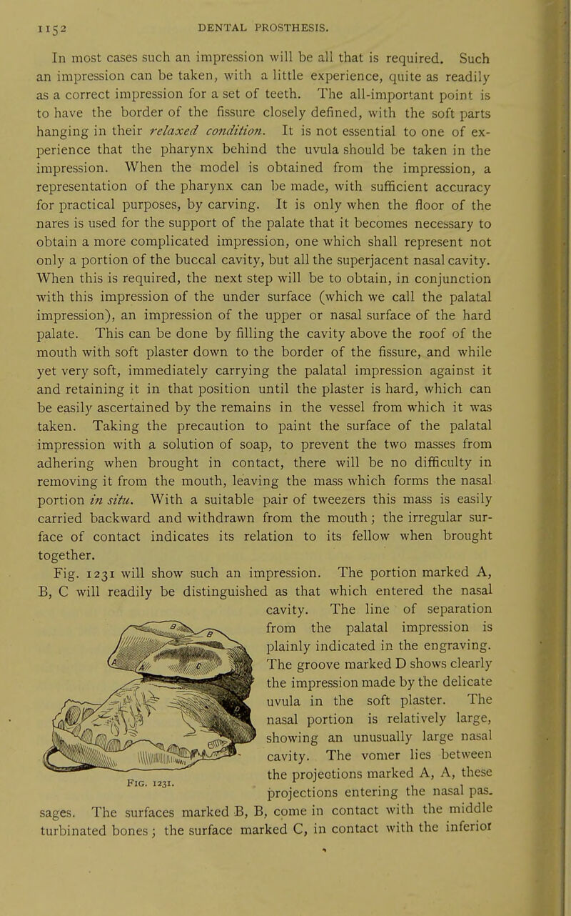 In most cases such an impression will be all that is required. Such an impression can be taken, with a little experience, quite as readily as a correct impression for a set of teeth. The all-important point is to have the border of the fissure closely defined, with the soft parts hanging in their relaxed co7idition. It is not essential to one of ex- perience that the pharynx behind the uvula should be taken in the impression. When the model is obtained from the impression, a representation of the pharynx can be made, with sufficient accuracy for practical purposes, by carving. It is only when the floor of the nares is used for the support of the palate that it becomes necessary to obtain a more complicated impression, one which shall represent not only a portion of the buccal cavity, but all the superjacent nasal cavity. When this is required, the next step will be to obtain, in conjunction with this impression of the under surface (which we call the palatal impression), an impression of the upper or nasal surface of the hard palate. This can be done by filling the cavity above the roof of the mouth with soft plaster down to the border of the fissure, and while yet very soft, immediately carrying the palatal impression against it and retaining it in that position until the plaster is hard, which can be easily ascertained by the remains in the vessel from which it was taken. Taking the precaution to paint the surface of the palatal impression with a solution of soap, to prevent the two masses from adhering when brought in contact, there will be no difficulty in removing it from the mouth, leaving the mass Avhich forms the nasal portion in situ. With a suitable pair of tweezers this mass is easily carried backward and withdrawn from the mouth; the irregular sur- face of contact indicates its relation to its fellow when brought together. Fig. 1231 will show such an impression. The portion marked A, B, C will readily be distinguished as that which entered the nasal cavity. The line of separation from the palatal impression is plainly indicated in the engraving. The groove marked D shows clearly the impression made by the delicate uvula in the soft plaster. The nasal portion is relatively large, showing an unusually large nasal cavity. The vomer lies between the projections marked A, A, these projections entering the nasal pas. sages. The surfaces marked B, B, come in contact with the middle turbinated bones; the surface marked C, in contact with the inferior