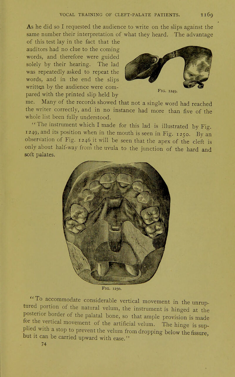 As he did so I requested the audience to write on the slips against the same number their interpretation of what they heard. The advantage of this test lay in the fact that the auditors had no clue to the coming words, and therefore were guided solely by their hearing. The lad was repeatedly asked to repeat the words, and in the end the slips writtgi by the audience were com- pared with the printed slip held by me. Many of the records showed that not a single word had reached the writer correctly, and in no instance had more than five of the whole list been fully understood. The instrument which I made for this lad is illustrated by Fig. 1249, and its position when in the mouth is seen in Fig. 1250. By an observation of Fig. i246j't will be seen that the apex of the cleft is only about half-way fron^ the uvula to the junction of the hard and soft palates. Fig. 1249. Fig. 1250. To accommodate considerable vertical movement in the unrup^ tured portion of the natural velum, the instrument is hinged at the posterior border of the palatal bone, so that ample provision is made tor the vertical movement of the artificial velum. The hinge is sup- .phed with a stop to prevent the velum from dropping below the fissure, Dut It can be carried upward with ease. 74