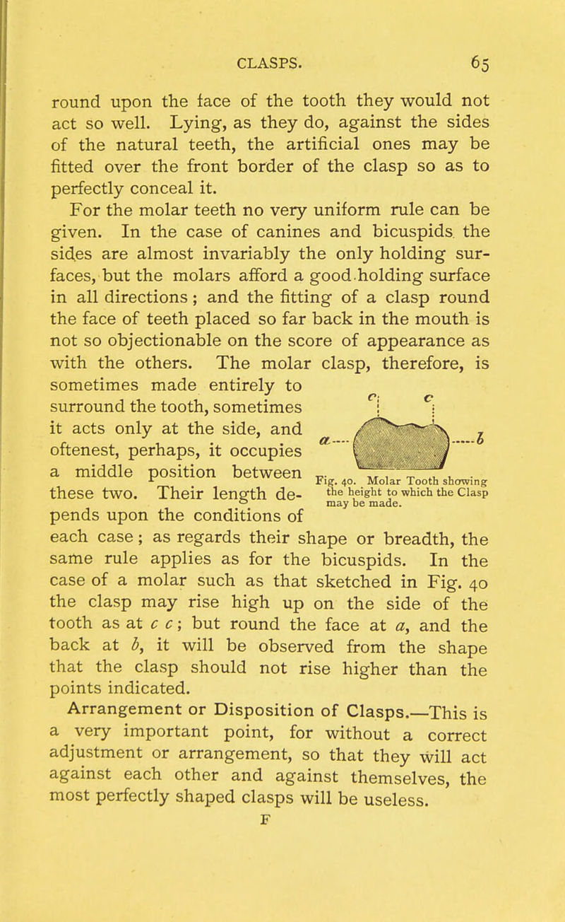 round upon the face of the tooth they would not act so well. Lying, as they do, against the sides of the natural teeth, the artificial ones may be fitted over the front border of the clasp so as to perfectly conceal it. For the molar teeth no very uniform rule can be given. In the case of canines and bicuspids the sides are almost invariably the only holding sur- faces, but the molars afford a good.holding surface in all directions; and the fitting of a clasp round the face of teeth placed so far back in the mouth is not so objectionable on the score of appearance as with the others. The molar clasp, therefore, is sometimes made entirely to surround the tooth, sometimes : ^\ it acts only at the side, and pends upon the conditions of each case; as regards their shape or breadth, the same rule applies as for the bicuspids. In the case of a molar such as that sketched in Fig. 40 the clasp may rise high up on the side of the tooth a.s at c c; but round the face at a, and the back at d, it will be observed from the shape that the clasp should not rise higher than the points indicated. Arrangement or Disposition of Clasps.—This is a very important point, for without a correct adjustment or arrangement, so that they will act against each other and against themselves, the most perfectly shaped clasps will be useless. may be made. F