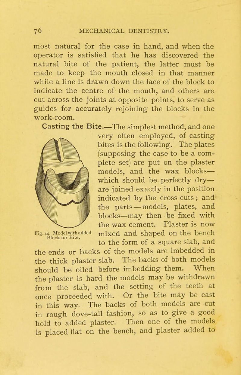 most natural for the case in hand, and when the operator is satisfied that he has discovered the natural bite of the patient, the latter must be made to keep the mouth closed in that manner while a line is drawn down the face of the block to indicate the centre of the mouth, and others are cut across the joints at opposite points, to serve as guides for accurately rejoining the blocks in the work-room. Casting the Bite—The simplest method, and one very often employed, of casting bites is the following. The plates (supposing the case to be a com- plete set) are put on the plaster models, and the wax blocks— which should be perfectly dry- are joined exactly in the position indicated by the cross cuts ; and the parts—models, plates, and blocks—may then be fixed with the wax cement. Plaster is now mixed and shaped on the bench to the form of a square slab, and the ends or backs of the models are imbedded in the thick plaster slab. The backs of both models should be oiled before imbedding them. When the plaster is hard the models may be withdrawn from the slab, and the setting of the teeth at once proceeded with. Or the bite may be cast in this way. The backs of both models are cut in rough dove-tail fashion, so as to give a good hold to added plaster. Then one of the models is placed flat on the bench, and plaster added to Fig. 44- Model with added Block for Bite.