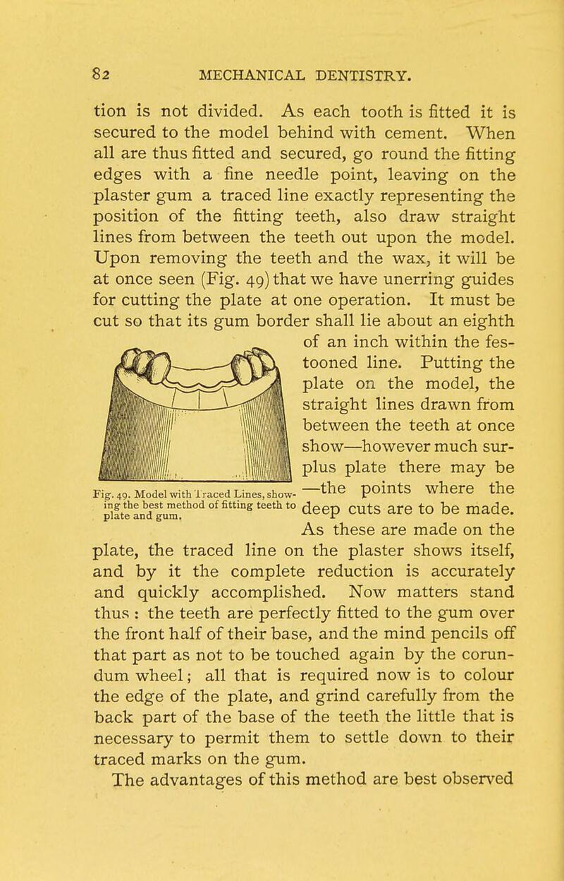 tion is not divided. As each tooth is fitted it is secured to the model behind with cement. When all are thus fitted and secured, go round the fitting edges with a fine needle point, leaving on the plaster gum a traced line exactly representing the position of the fitting teeth, also draw straight lines from between the teeth out upon the model. Upon removing the teeth and the wax, it will be at once seen (Fig. 49) that we have unerring guides for cutting the plate at one operation. It must be cut so that its gum border shall lie about an eighth Fig. 49. Model with i raced Lines, show- poiutS wherC the 'llt^and°^'^^'^ *° ^®6p cuts are to be made. plate, the traced line on the plaster shows itself, and by it the complete reduction is accurately and quickly accomplished. Now matters stand thus : the teeth are perfectly fitted to the gum over the front half of their base, and the mind pencils off that part as not to be touched again by the corun- dum wheel; all that is required now is to colour the edge of the plate, and grind carefully from the back part of the base of the teeth the little that is necessary to permit them to settle down to their traced marks on the gum. The advantages of this method are best observed of an inch within the fes- tooned line. Putting the plate on the model, the straight lines drawn from between the teeth at once show—however much sur- plus plate there may be As these are made on the