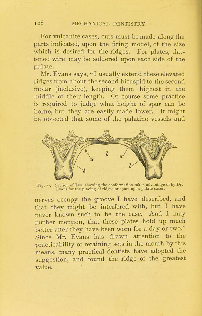 For vulcanite cases, cuts must be made along the parts indicated, upon the firing model, of the size which is desired for the ridges. For plates, flat- tened wire may be soldered upon each side of the palate. Mr. Evans says, I usually extend these elevated ridges from about the second bicuspid to the second molar (inclusive), keeping them highest in the middle of their length. Of course some practice is required to judge what height of spur can be borne, but they are easily made lower. It might be objected that some of the palatine vessels and Fig. 77. Section of Jaw, showing the conformation taken advantage of by Dr. Evans for the placing of ridges or spurs upon palate cases. nerves occupy the groove I have described, and that they might be interfered with, but I have never known such to be the case. And I may further mention, that these plates hold up much better after they have been worn for a day or two. Since Mr. Evans has drawn attention to the practicability of retaining sets in the mouth by this means, many practical dentists have adopted the suggestion, and found the ridge of the greatest value.