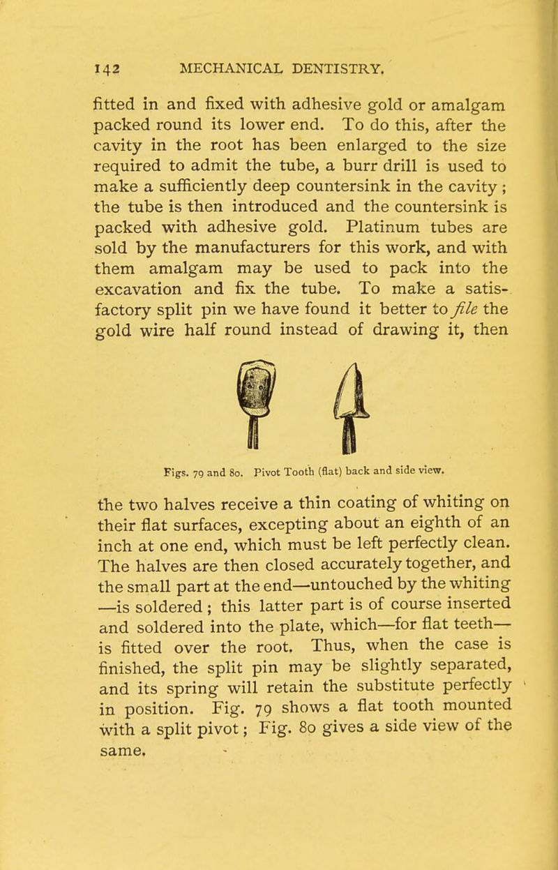 fitted in and fixed with adhesive gold or amalgam packed round its lower end. To do this, after the cavity in the root has been enlarged to the size required to admit the tube, a burr drill is used to make a sufficiently deep countersink in the cavity ; the tube is then introduced and the countersink is packed with adhesive gold. Platinum tubes are sold by the manufacturers for this work, and with them amalgam may be used to pack into the excavation and fix the tube. To make a satis- factory split pin we have found it better to file the gold wire half round instead of drawing it, then Figs. 79 and 80. Pivot Tooth (flat) back and side view. the two halves receive a thin coating of whiting on their flat surfaces, excepting about an eighth of an inch at one end, which must be left perfectly clean. The halves are then closed accurately together, and the small part at the end—untouched by the whiting —is soldered ; this latter part is of course inserted and soldered into the plate, which—for flat teeth- is fitted over the root. Thus, when the case is finished, the split pin may be slightly separated, and its spring will retain the substitute perfectly in position. Fig. 79 shows a flat tooth mounted with a split pivot; Fig. 80 gives a side view of the same.