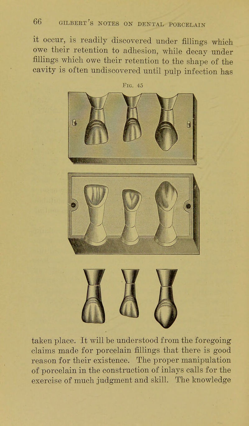 it occur, is readily discovered under fillings which owe their retention to adhesion, while decay under fillings which owe their retention to the shape of the cavity is often undiscovered until pulp infection has Fig. 45 taken place. It will be understood from the foregoing claims made for porcelain fillings that there is good reason for their existence. The proper manipulation of porcelain in the construction of inlays calls for the exercise of much judgment and skill. The knowledge