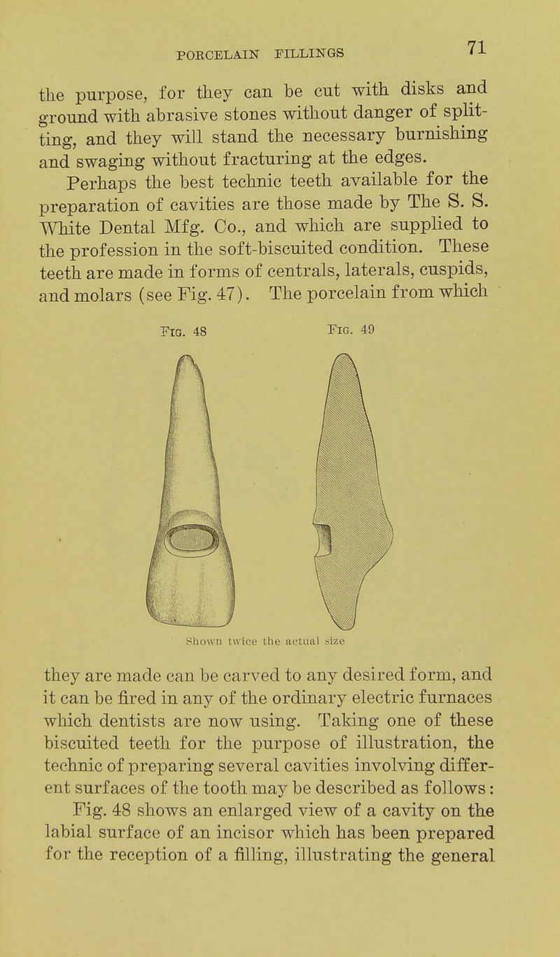 the purpose, for they can be cut with disks and ground with abrasive stones without danger of split- ting, and they will stand the necessary burnishing and swaging without fracturing at the edges. Perhaps the best technic teeth available for the preparation of cavities are those made by The S. S. White Dental Mfg. Co., and which are supplied to the profession in the soft-biscuited condition. These teeth are made in forms of centrals, laterals, cuspids, and molars (see Fig. 47). The porcelain from which Fig. 48 Fig. 49 shown twice the iiclual size they are made can be carved to any desired form, and it can be fired in any of the ordinary electric furnaces which dentists are now using. Taking one of these biscuited teeth for the purpose of illustration, the technic of preparing several cavities involving differ- ent surfaces of the tooth may be described as follows: Fig. 48 shows an enlarged view of a cavity on the labial surface of an incisor which has been prepared for the reception of a filling, illustrating the general