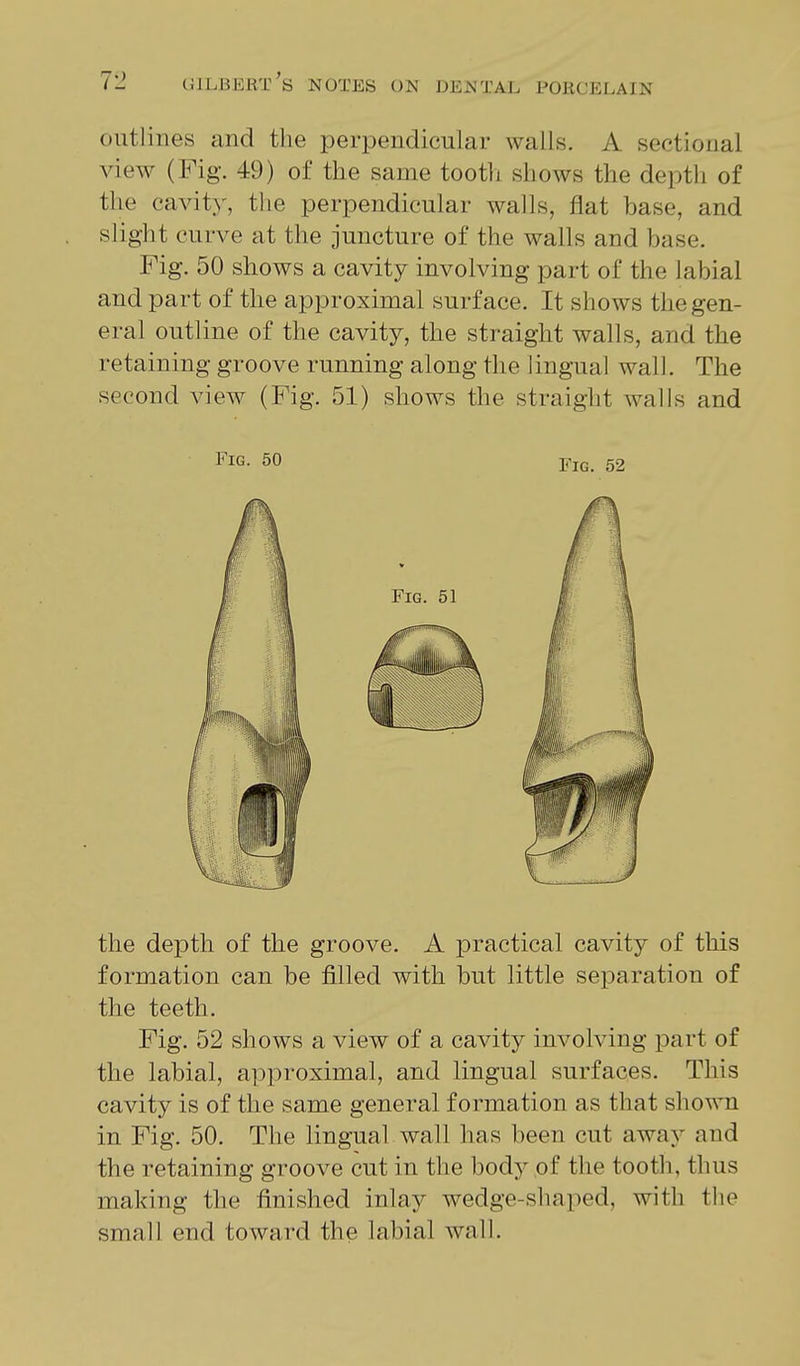 outlines and the perpendicular walls. A sectional view (Fig. 49) of the same tootli shows the depth of the cavit}', the perpendicular walls, flat base, and slight curve at the juncture of the walls and base. Fig. 50 shows a cavity involving part of the labial and part of the approximal surface. It shows the gen- eral outline of the cavity, the straight walls, and the retaining groove running along the lingual wall. The second view (Fig. 51) shows the straight walls and the depth of the groove. A practical cavity of this formation can be filled with but little separation of the teeth. Fig. 52 shows a view of a cavity involving part of the labial, approximal, and lingual surfaces. This cavity is of the same general formation as that shown in Fig. 50. The lingual wall has been cut away and the retaining groove cut in the bodj^ of the tooth, thus making the finished inlay wedge-shaped, with the small end toward the labial wall. Fig. 50 Fig. 52