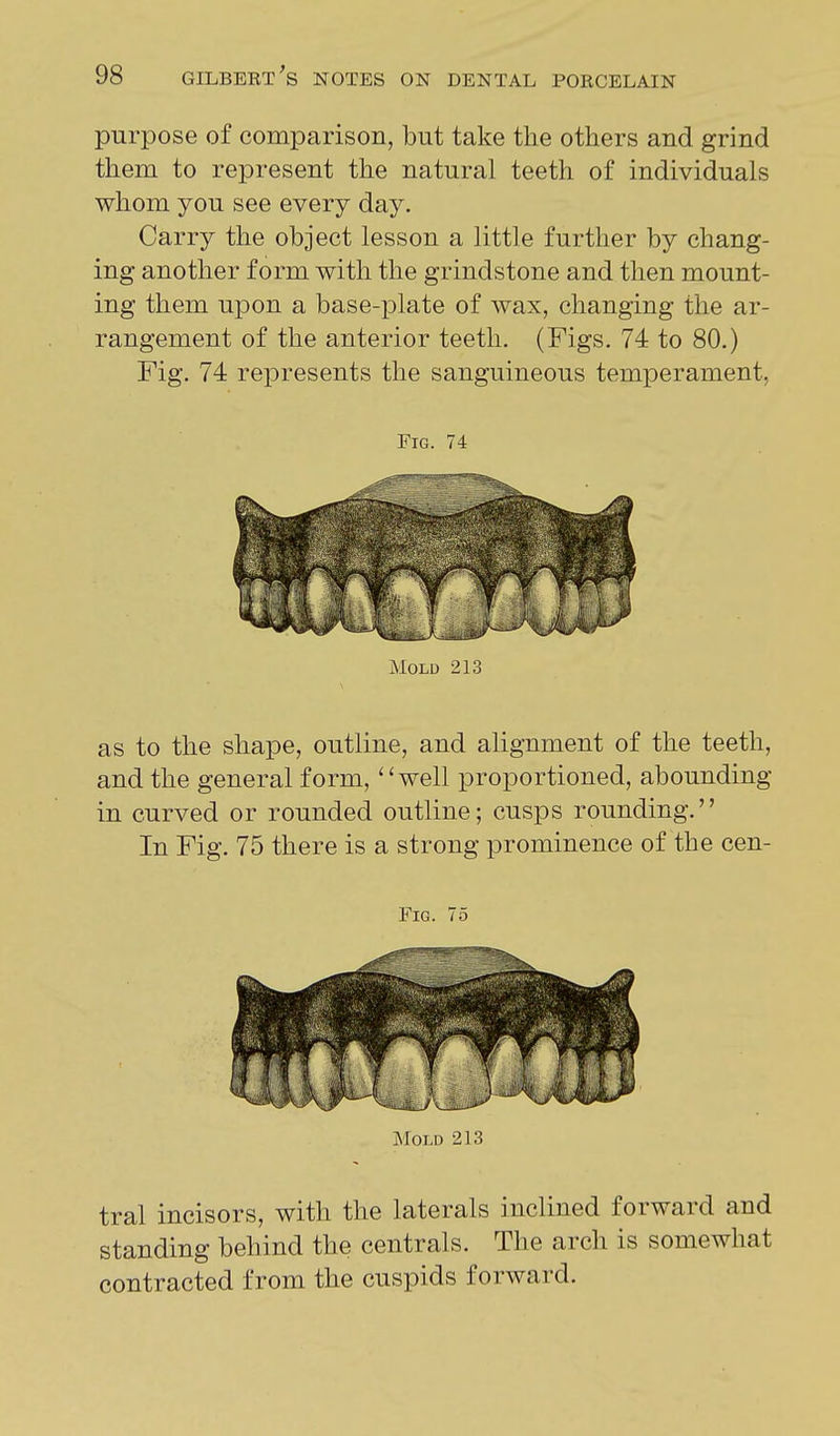 purpose of comparison, but take the others and grind them to represent the natural teeth of individuals whom you see every day. Carry the object lesson a little further by chang- ing another form with the grindstone and then mount- ing them upon a base-plate of wax, changing the ar- rangement of the anterior teeth. (Figs. 74 to 80.) Fig. 74 represents the sanguineous temperament, Fig. 74 Mold 213 as to the shape, outline, and alignment of the teeth, and the general form, ''well proportioned, abounding in curved or rounded outline; cusps rounding. In Fig. 75 there is a strong prominence of the cen- FiG. 75 Mold 213 tral incisors, with the laterals inclined forward and standing behind the centrals. The arch is somewhat contracted from the cuspids forward.