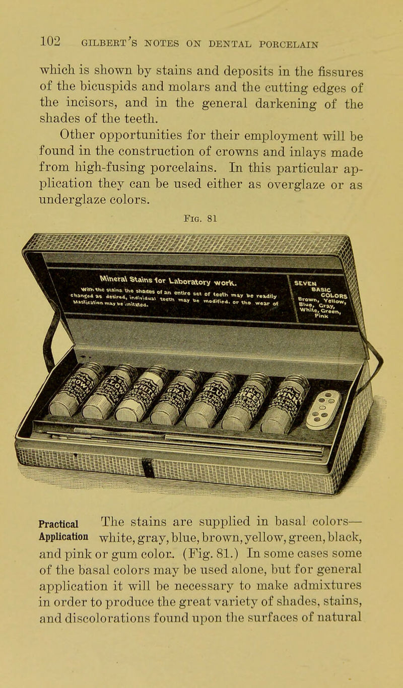 which is shown by stains and deposits in the fissures of the bicuspids and molars and the cutting edges of the incisors, and in the general darkening of the shades of the teeth. Other opportunities for their employment will be found in the construction of crowns and inlays made from high-fusing porcelains. In this particular ap- plication they can be used either as overglaze or as underglaze colors. Fig. 81 ilii & o Practical The stains are supplied in basal colors— Application white, gray, blue, brown, yellow, green, bl ack, and pink or gum color. (Fig. 81.) In some cases some of the basal colors may be used alone, but for general application it will be necessary to make admixtures in order to produce the great variety of shades, stains, and disco! orations found upon the surfaces of natural