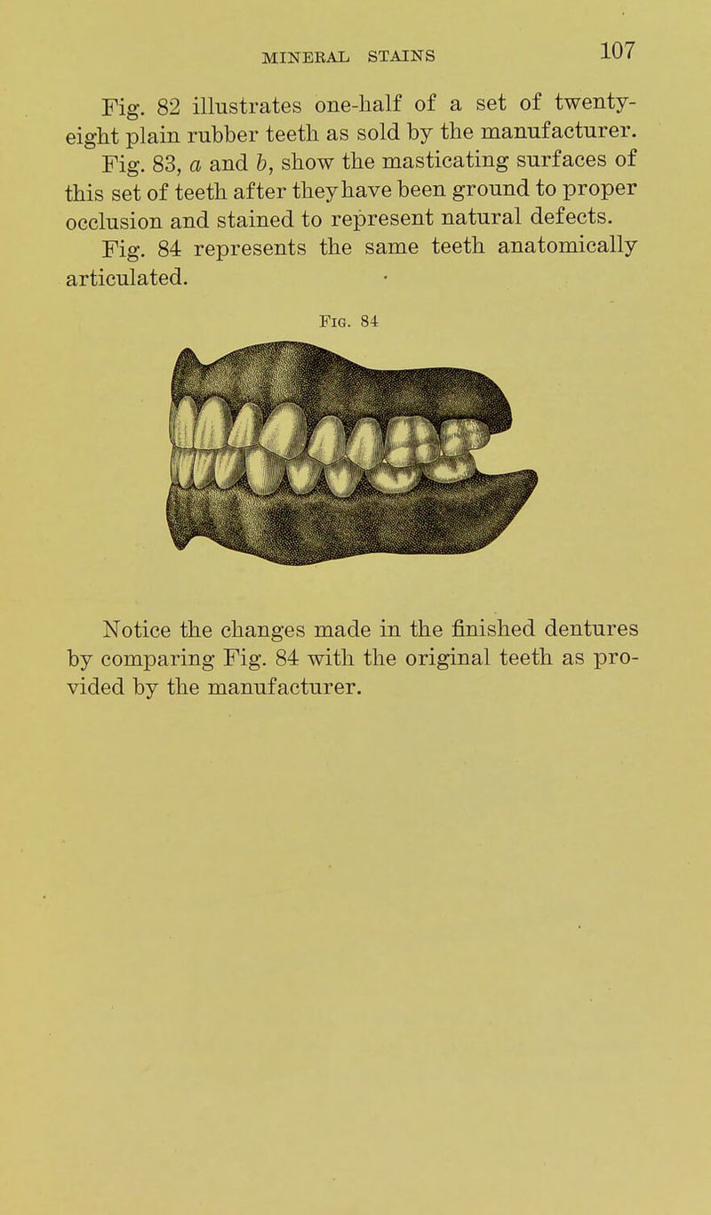 Fig. 82 illustrates one-lialf of a set of twenty- eight plain rubber teeth as sold by the manufacturer. Fig. 83, a and h, show the masticating surfaces of this set of teeth after they have been ground to proper occlusion and stained to represent natural defects. Fig. 84 represents the same teeth anatomically articulated. Pig. 84 Notice the changes made in the finished dentures by comparing Fig. 84 with the original teeth as pro- vided by the manufacturer.