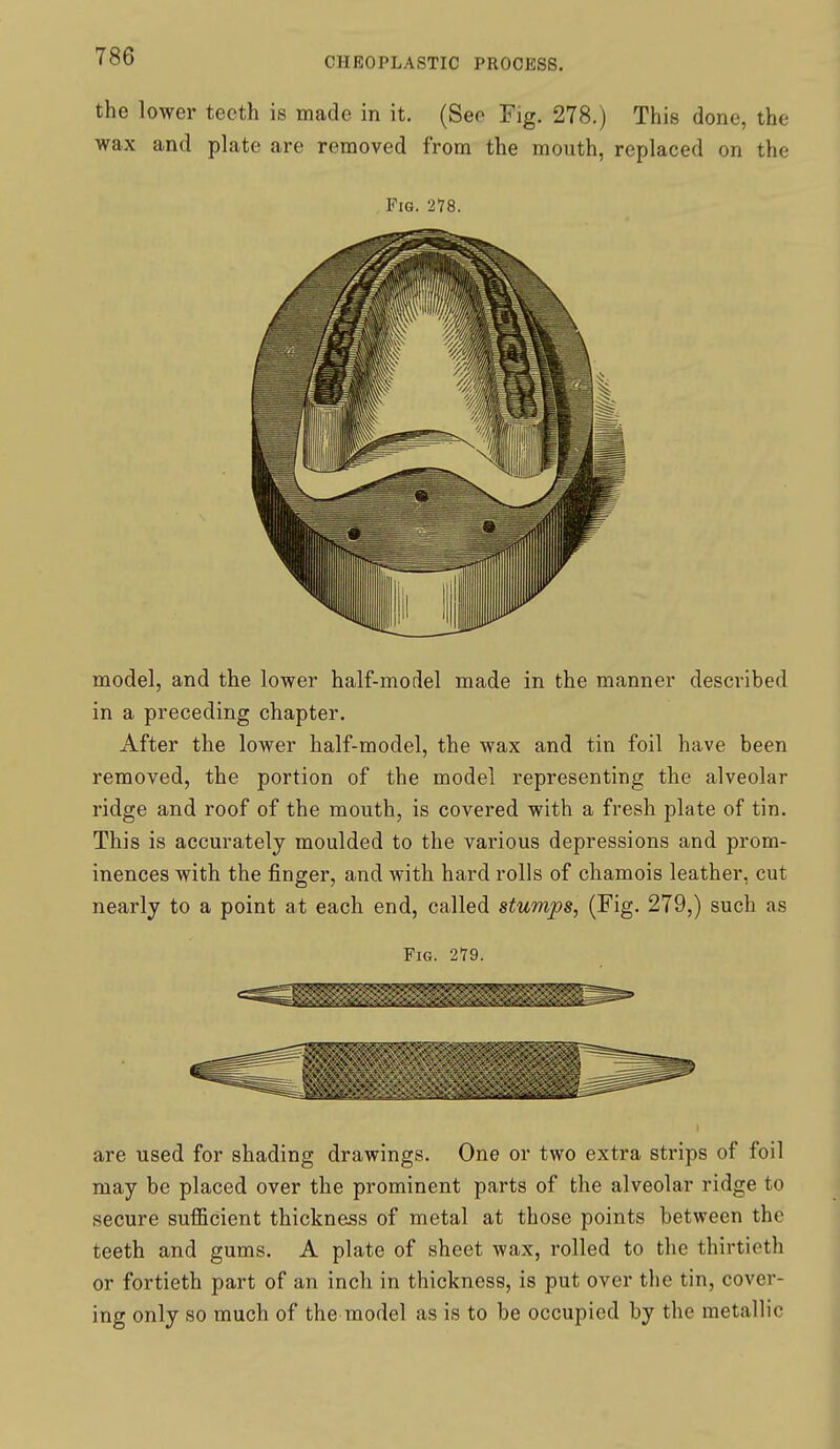 the lower teeth is made in it. (See Fig. 278.) This done, the wax and plate are removed from the mouth, replaced on the , Fig. 278. model, and the lower half-model made in the manner described in a preceding chapter. After the lower half-model, the wax and tin foil have been removed, the portion of the model representing the alveolar ridge and roof of the mouth, is covered with a fresh plate of tin. This is accurately moulded to the various depressions and prom- inences with the finger, and with hard rolls of chamois leather, cut nearly to a point at each end, called stumps, (Fig. 279,) such as Fig. 279. are used for shading drawings. One or two extra strips of foil may be placed over the prominent parts of the alveolar ridge to secure sufficient thickness of metal at those points between the teeth and gums. A plate of sheet wax, rolled to the thirtieth or fortieth part of an inch in thickness, is put over the tin, cover- ing only so much of the model as is to be occupied by the metallic