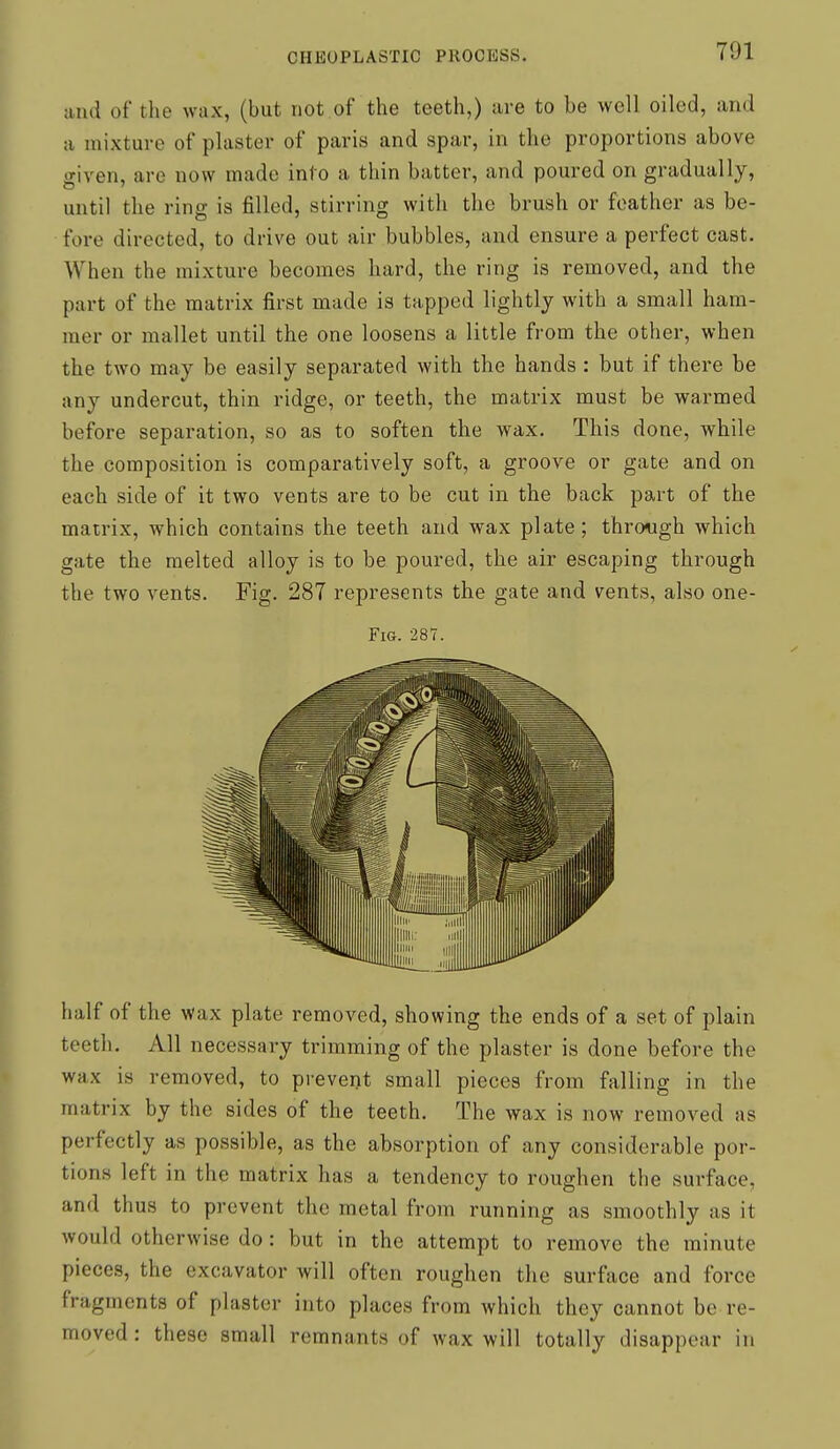 and of the wax, (but not of the teeth,) are to be well oiled, and a mixture of plaster of paris and spar, in the proportions above given, are now made into a thin batter, and poured on gradually, until the ring is filled, stirring with the brush or feather as be- fore directed, to drive out air bubbles, and ensure a perfect cast. When the mixture becomes hard, the ring is removed, and the part of the matrix first made is tapped lightly with a small ham- mer or mallet until the one loosens a little from the other, when the two may be easily separated with the hands : but if there be any undercut, thin ridge, or teeth, the matrix must be warmed before separation, so as to soften the wax. This done, while the composition is comparatively soft, a groove or gate and on each side of it two vents are to be cut in the back part of the matrix, which contains the teeth and wax plate; through which gate the melted alloy is to be poured, the air escaping through the two vents. Fig. 287 represents the gate and vents, also one- FiG. 287. half of the wax plate removed, showing the ends of a set of plain teeth. All necessary trimming of the plaster is done before the wax is removed, to prevent small pieces from falling in the matrix by the sides of the teeth. The wax is now removed as perfectly as possible, as the absorption of any considerable por- tions left in the matrix has a tendency to roughen the surface, and thus to prevent the metal from running as smoothly as it would otherwise do: but in the attempt to remove the minute pieces, the excavator will often roughen the surface and force fragments of plaster into places from which they cannot be re- moved : these small remnants of wax will totally disappear in