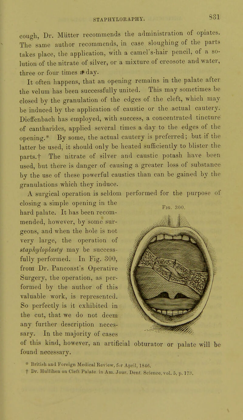 cough, Dr. Mutter recommends the administration of opiates. The same author recommends, in case sloughing of the parts takes place, the application, with a camel's-hair pencil, of a so- lution of the nitrate of silver, or a mixture of creosote and water, three or four times * day. It often happens, that an opening remains in the palate after the velum has been successfully united. This may sometimes be closed by the granulation of the edges of the cleft, which may be induced by the application of caustic or the actual cautery. Dieffenbach has employed, with success, a concentrated tincture of cantharides, applied several times a day to the edges of the opening.* By some, the actual cautery is prefeiTed; but if the latter be used, it should only be heated sufficiently to blister the parts.t The nitrate of silver and caustic potash have been used, but there is danger of causing a greater loss of substance by the use of these powerful caustics than can be gained by the granulations which they induce. A surgical operation is seldom performed for the purpose of closing a simple opening in the hard palate. It has been recom- mended, however, by some sur- geons, and when the hole is not very large, the operation of stapliyloijlasty may be success- fully performed. In Fig. 300, from Dr. Pancoast's Operative Surgery, the operation, as per- formed by the author of this valuable work, is represented. So perfectly is it exhibited in the cut, that we do not deem any further description neces- sary. In the majority of cases of this kind, however, an artificial obturator or palate will be found necessary. » British and Foreign Medical Review, for April, 184R. t Dr. HuUihcn on Cleft Palate in Am.,Jour. Dent. Science, vol. 5, p. 17:<. FiCx. 300.