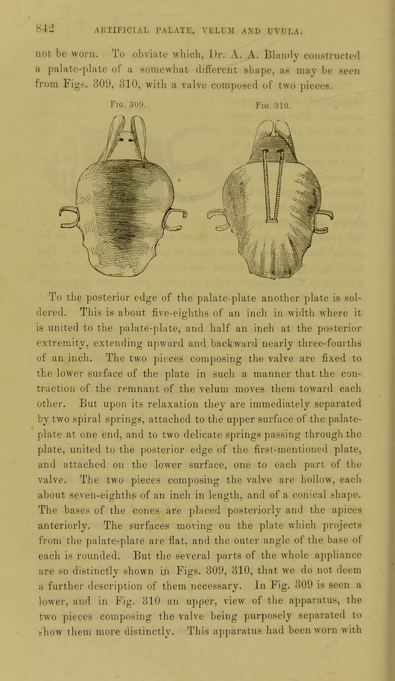 S42 not be worn. To obviate which, Dr. A. A. Bhindy constructed a palatc-phite of a somewhat difiercnt sliape, as may be seen from Fig.s. 309, 310, with a valve composed of tAvo pieces. Fui. 309. Fig. 310. To the posterior edge of the palate-plate another plate is sol- dered. This is about five-eighths of an inch in width where it is united to the palate-plate, and half an inch at the posterior extremity, extending upward and backward nearly three-fourths of an inch. The two pieces composing the valve are fixed to the lower surface of the plate in such a manner that the con- traction of the remnant of the velum moves them toward each other. But upon its relaxation they are immediately separated by two spiral springs, attached to the upper surface of the palate- plate at one end, and to two delicate springs passing through the plate, united to the posterior edge of the first-mentioned plate, and attached on the lower surface, one to each part of the valve. The two pieces composing the valve are hollow, each about seven-eighths of an inch in length, and of a conical shape. The bases of the cones are placed posteriorly and the apices anteriorly. The surfaces moving on the plate which projects from the palate-plate are flat, and the outer angle of the base of each is rounded. But the several parts of the whole appliance are so distinctly shown in Figs. 309, 310, that we do not deem a further description of them necessary. In Fig. 309 is seen a lower, and in Fig. 310 an upper, view of the apparatus, the two pieces composing the valve being purposely separated to fchow them more distinctly. This apparatus had been worn with