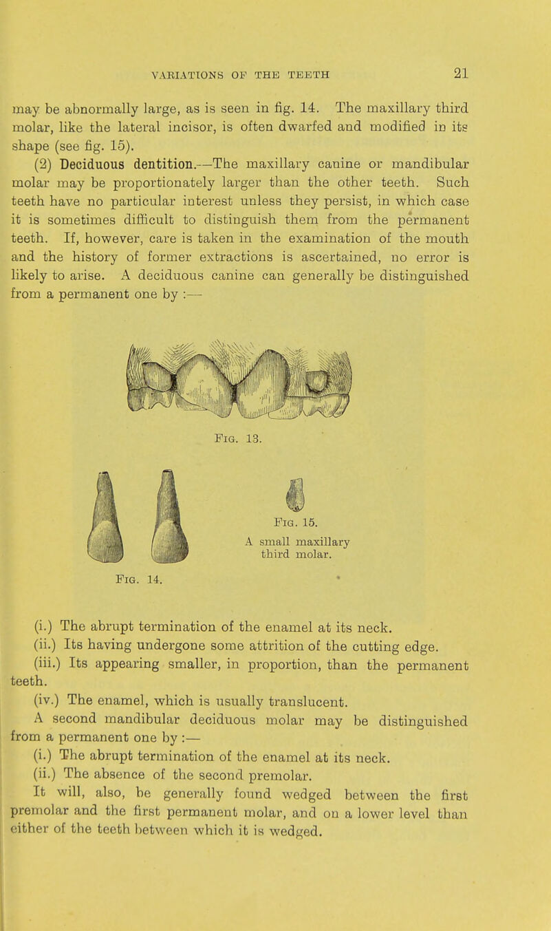 may be abnormally large, as is seen in fig. 14. The maxillary third molar, like the lateral incisor, is often dwarfed and modified in its shape (see fig. 15). (2) Deciduous dentition.—The maxillary canine or mandibular molar may be proportionately larger than the other teeth. Such teeth have no particular interest unless they persist, in which case it is sometimes difficult to distinguish them from the permanent teeth. If, however, care is taken in the examination of the mouth and the history of former extractions is ascertained, no error is likely to arise. A deciduous canine can generally be distinguished from a permanent one by :— Fig. 14. (i.) The abrupt termination of the enamel at its neck, (ii.) Its having undergone some attrition of the cutting edge, (iii.) Its appearing smaller, in proportion, than the permanent teeth. (iv.) The enamel, which is usually translucent. A second mandibular deciduous molar may be distinguished from a permanent one by :— (i.) The abrupt termination of the enamel at its neck, (ii.) The absence of the second premolar. It will, also, be generally found wedged between the first premolar and the first permanent molar, and on a lower level than either of the teeth between which it is wedged.