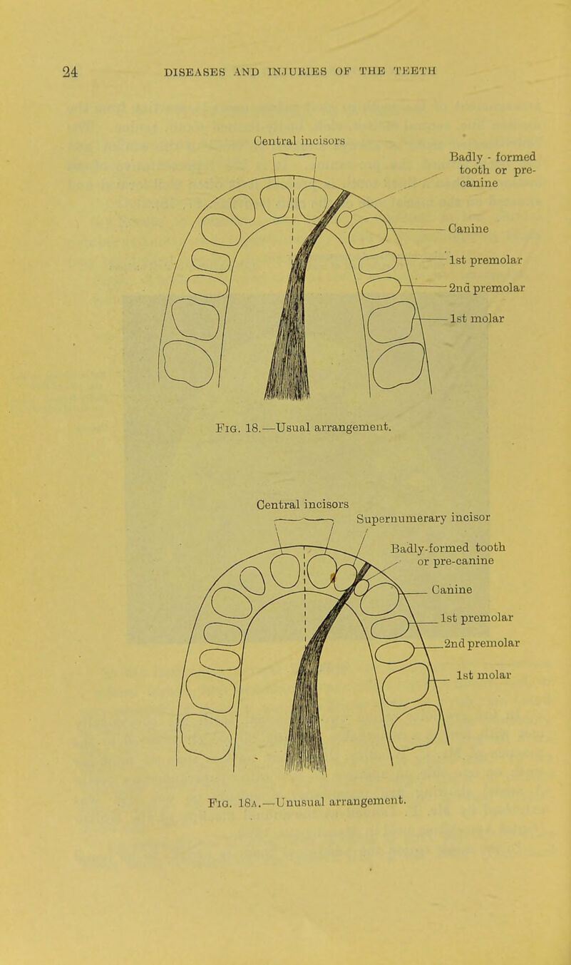 Fio. 18a.—Unusual arrangement.