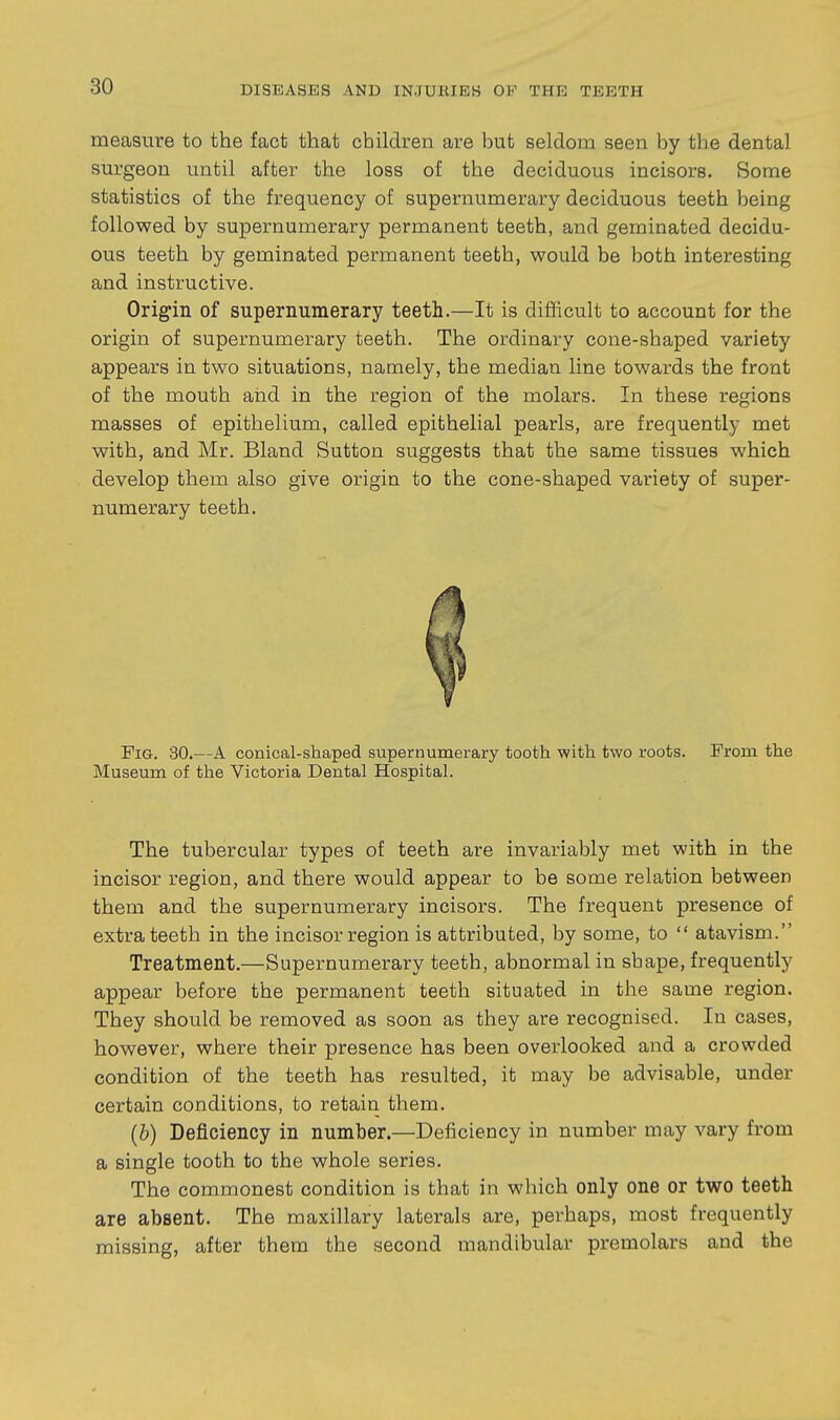 measure to the fact that children are but seldom seen by the dental surgeon until after the loss of the deciduous incisors. Some statistics of the frequency of supernumerary deciduous teeth being followed by supernumerary permanent teeth, and geminated decidu- ous teeth by geminated permanent teeth, would be both interesting and instructive. Origin of supernumerary teeth.—It is difficult to account for the origin of supernumerary teeth. The ordinary cone-shaped variety appears in two situations, namely, the median line towards the front of the mouth and in the region of the molars. In these regions masses of epithelium, called epithelial pearls, are frequently met with, and Mr. Bland Sutton suggests that the same tissues which develop them also give origin to the cone-shaped variety of super- numerary teeth. Pig. 30.—A conical-shaped supernumerary tooth with two roots. From the Museum of the Victoria Dental Hospital. The tubercular types of teeth are invariably met with in the incisor region, and there would appear to be some relation between them and the supernumerary incisors. The frequent presence of extra teeth in the incisor region is attributed, by some, to  atavism. Treatment.—Supernumerary teeth, abnormal in shape, frequently appear before the permanent teeth situated in the same region. They should be removed as soon as they are recognised. In cases, however, where their presence has been overlooked and a crowded condition of the teeth has resulted, it may be advisable, under certain conditions, to retain them. (6) Deficiency in number.—Deficiency in number may vary from a single tooth to the whole series. The commonest condition is that in which only one or two teeth are absent. The maxillary laterals are, perhaps, most frequently missing, after them the second mandibular premolars and the