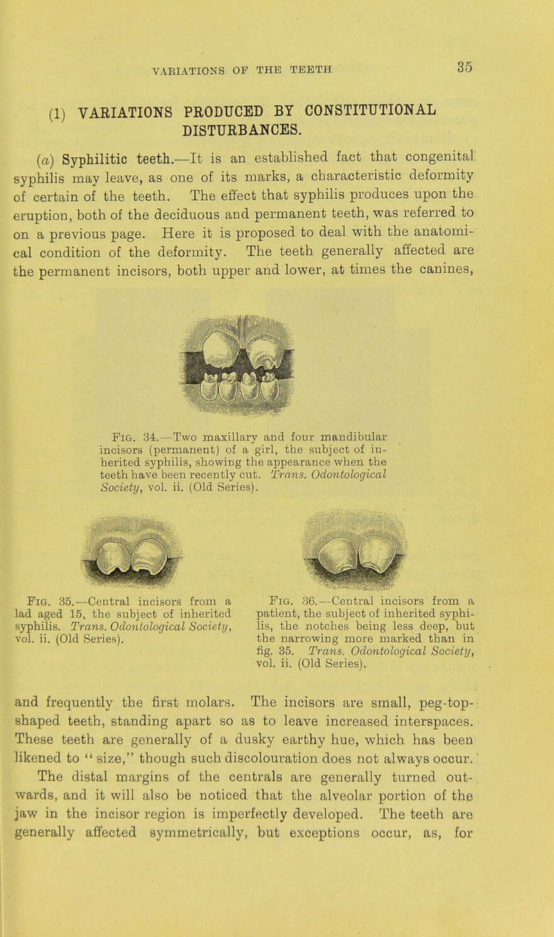 (1) VARIATIONS PRODUCED BY CONSTITUTIONAL DISTURBANCES. (a) Syphilitic teeth.—It is an established fact that congenital syphilis may leave, as one of its marks, a characteristic deformity of certain of the teeth. The effect that syphilis produces upon the eruption, both of the deciduous and permanent teeth, was referred to on a previous page. Here it is proposed to deal with the anatomi- cal condition of the deformity. The teeth generally affected are the permanent incisors, both upper and lower, at times the canines, Pig. 34.—Two maxillary and four mandibular incisors (permanent) of a girl, the subject of in- herited syphilis, showing the appearance when the teeth have been recently cut. Trans. Odontological Society, vol. ii. (Old Series). Fig. 35.—Central incisors from a lad aged 15, the subject of inherited syphilis. Trans. Odontological Society, vol. ii. (Old Series). Fig. 36.—Central incisors from a patient, the subject of inherited syphi- lis, the notches being less deep, hut the narrowing more marked than in fig. 35. Trans. Odontological Society, vol. ii. (Old Series). and frequently the first molars. The incisors are small, peg-top- shaped teeth, standing apart so as to leave increased interspaces. These teeth are generally of a dusky earthy hue, which has been likened to  size, though such discolouration does not always occur. The distal margins of the centrals are generally turned out- wards, and it will also be noticed that the alveolar portion of the jaw in the incisor region is imperfectly developed. The teeth are generally affected symmetrically, but exceptions occur, as, for