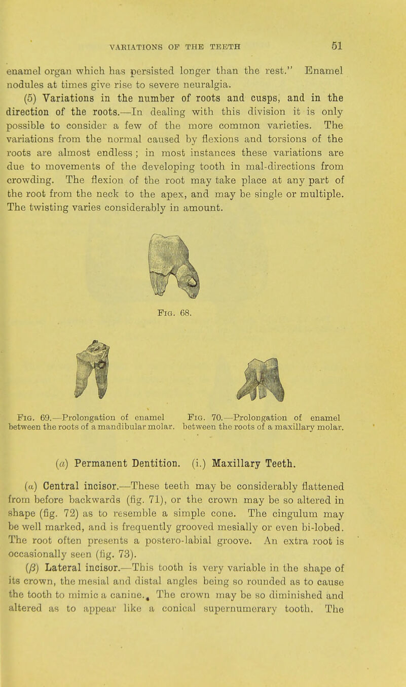 enamel organ which has persisted longer than the rest. Enamel nodules at times give rise to severe neuralgia. (5) Variations in the number of roots and cusps, and in the direction of the roots.—In dealing with this division it is only- possible to consider a few of the more common varieties. The variations from the normal caused by flexions and torsions of the roots are almost endless ; in most instances these variations are due to movements of the developing tooth in mal-directions from crowding. The flexion of the root may take place at any part of the root from the neck to the apex, and may be single or multiple. The twisting varies considerably in amount. Fig. 69.—Prolongation of enamel Fig. 70.—Prolongation of enamel between the roots of a mandibular molar, between the roots of a maxillary molar. (a) Permanent Dentition, (i.) Maxillary Teeth. (a) Central incisor.—These teeth may be considerably flattened from before backwards (fig. 71), or the crown may be so altered in shape (fig. 72) as to resemble a simple cone. The cingulum may be well marked, and is frequently grooved mesially or even bi-lobed. The root often presents a postero-labial groove. An extra root is occasionally seen (lig. 73). {(3) Lateral incisor.—This tooth is very variable in the shape of its crown, the mesial and distal angles being so rounded as to cause the tooth to mimic a canine.. The crown may be so diminished and altered as to appeal- like a conical supernumerary tooth. The