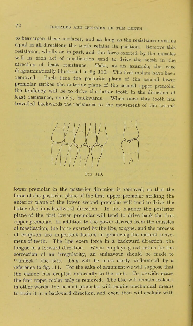 to bear upon these surfaces, and as long as the resistance remains equal in all directions the tooth retains its position. Eemove this resistance, wholly or in part, and the force exerted by the muscles will in each act of mastication tend to drive the teeth in the direction of least resistance. Take, as an example, the case diagrammatically illustrated in fig. 110. The first molars have been removed. Each time the posterior plane of the second lower premolar strikes the anterior plane of the second upper premolar the tendency will be to drive the latter tooth in the direction of least resistance, namely, backwards. When once this tooth has travelled backwards the resistance to the movement of the second Fig. 110. lower premolar in the posterior direction is removed, so that the force of the posterior plane of the first upper premolar striking the anterior plane of the lower second premolar will tend to drive the latter also in a backward direction. In like manner the posterior plane of the first lower premolar will tend to drive back the first upper premolar. In addition to the power derived from the muscles of mastication, the force exerted by the lips, tongue, and the process of eruption are important factors in producing the natural move- ment of teeth. The lips exert force in a backward direction, the tongue in a forward direction. When employing extraction for the correction of an irregularity, an endeavour should be made to unlock the bite. This will be more easily understood by a reference to fig. 111. For the sake of argument we will suppose that the canine has erupted externally to the arch. To provide space the first upper molar only is removed. The bite will remain locked ; in other words, the second premolar will require mechanical means to train it in a backward direction, and even then will occlude with