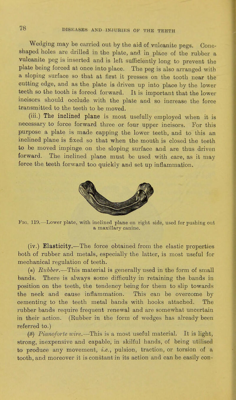 Wedging may be carried out by the aid of vulcanite pegs. Gone- shaped holes are drilled in the plate, and in place of the rubber a vulcanite peg is inserted and is left sufficiently long to prevent the plate being forced at once into place. The peg is also arranged with a sloping surface so that at first it presses on the tooth near the cutting edge, and as the plate is driven up into place by the lower teeth so the tooth is forced forward. It is important that the lower incisors should occlude with the plate and so increase the force transmitted to the teeth to be moved. (iii.) The inclined plane is most usefully employed when it is necessary to force forward three or four upper incisors. For this purpose a plate is made capping the lower teeth, and to this an inclined plane is fixed so that when the mouth is closed the teeth to be moved impinge on the sloping surface and are thus driven forward. The inclined plane must be used with care, as it may force the teeth forward too quickly and set up inflammation. Fig. 119.—Lower plate, with inclined plane on right side, used for pushing out a maxillary canine. (iv.) Elasticity.—The force obtained from the elastic properties both of rubber and metals, especially the latter, is most useful for mechanical regulation of teeth. (a) Bubber.—This material is generally used in the form of small bands. There is always some difficulty in retaining the bands in position on the teeth, the tendency being for them to slip towards the neck and cause inflammation. This can be overcome by cementing to the teeth metal bands with hooks attached. The rubber bands require frequent renewal and are somewhat uncertain in their action. (Eubber in the form of wedges has already been referred to.) (/3) Pianoforte wire.—This is a most useful material. It is light, strong, inexpensive and capable, in skilful hands, of being utilised to produce any movement, i.e., pulsion, traction, or torsion of a tooth, and moreover it is constant in its action and can be easily con-