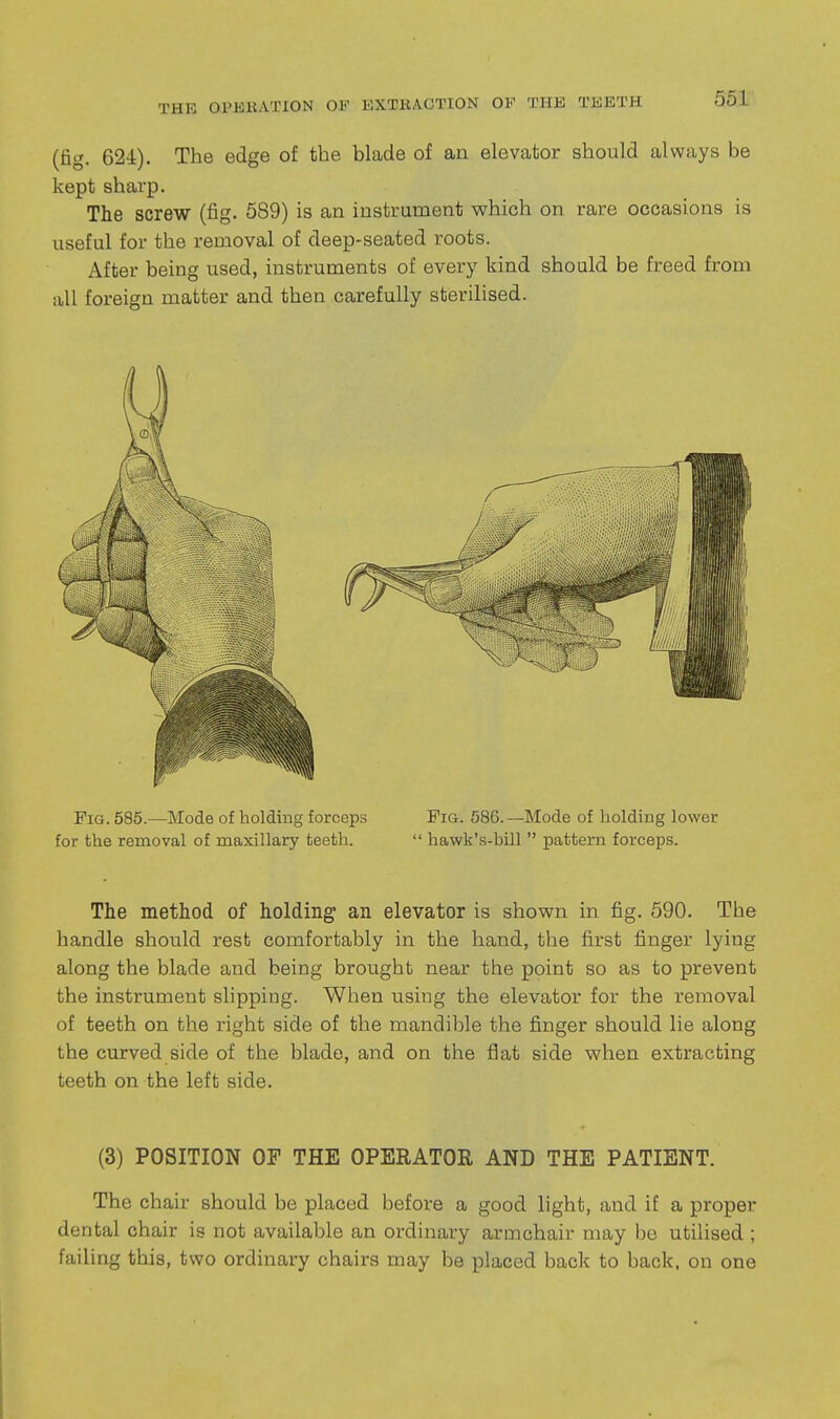 (fig. 62i). The edge of the blade of an elevator should always be kept sharp. The screw (fig. 589) is an instrument which on rare occasions is useful for the removal of deep-seated roots. After being used, instruments of every kind should be freed from all foreign matter and then carefully sterilised. Fig. 585.—Mode of holding forceps Fig. 586.—Mode of holding lower for the removal of maxillary teeth.  hawk'.s-bill  pattern forceps. The method of holding an elevator is shown in fig. 590. The handle should rest comfortably in the hand, the first finger lying along the blade and being brought near the point so as to prevent the instrument slipping. When using the elevator for the removal of teeth on the right side of the mandible the finger should lie along the curved side of the blade, and on the flat side when extracting teeth on the left side. (3) POSITION OF THE OPERATOR AND THE PATIENT. The chair should be placed before a good light, and if a proper dental chair is not available an ordinary armchair may bo utilised ; failing this, two ordinary chairs may be placed back to back, on one