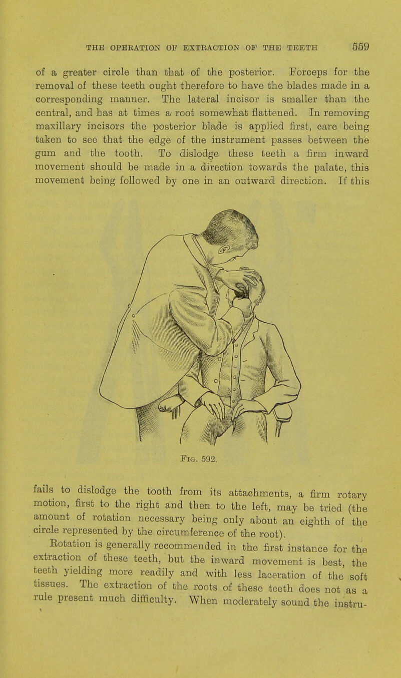 of a greater circle than that of the posterior. Forceps for the removal of these teeth ought therefore to have the blades made in a corresponding manner. The lateral incisor is smaller than the central, and has at times a root somewhat flattened. In removing maxillary incisors the posterior blade is applied first, care being taken to see that the edge of the instrument passes between the gum and the tooth. To dislodge these teeth a firm inward movement should be made in a direction towards the palate, this movement being followed by one in an outward direction. If this fails to dislodge the tooth from its attachments, a firm rotary motion, first to the right and then to the left, may be tried (the amount of rotation necessary being only about an eighth of the circle represented by the circumference of the root). Eotation is generally recommended in the first instance for the extraction of these teeth, but the inward movement is best, the teeth yielding more readily and with less laceration of the' soft tissues. The extraction of the roots of these teeth does not as a rule present much difficulty. When moderately sound the instru-