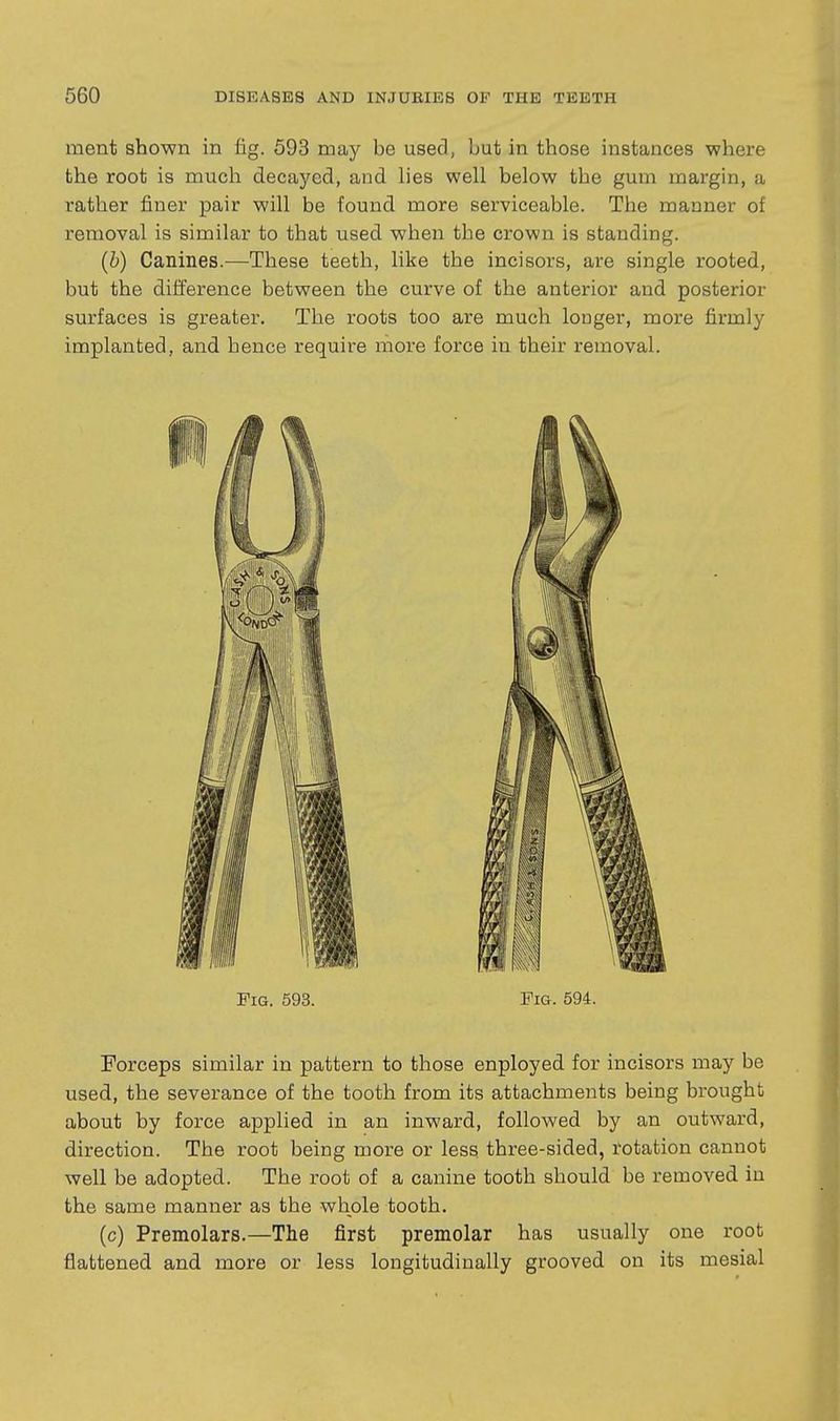 ment shown in fig. 593 may be used, but in those instances where the root is much decayed, and lies well below the gum margin, a rather finer pair will be found more serviceable. The manner of removal is similar to that used when the crown is standing. (h) Canines.—These teeth, like the incisors, are single rooted, but the difference between the curve of the anterior and posterior surfaces is greater. The roots too are much longer, more firmly implanted, and hence require more force in their removal. Fig. 593. Fig. 594. Forceps similar in pattern to those enployed for incisors may be used, the severance of the tooth from its attachments being brought about by force applied in an inward, followed by an outward, direction. The root being more or less three-sided, rotation cannot well be adopted. The root of a canine tooth should be removed in the same manner as the whole tooth. (c) Premolars.—The first premolar has usually one root flattened and more or less longitudinally grooved on its mesial