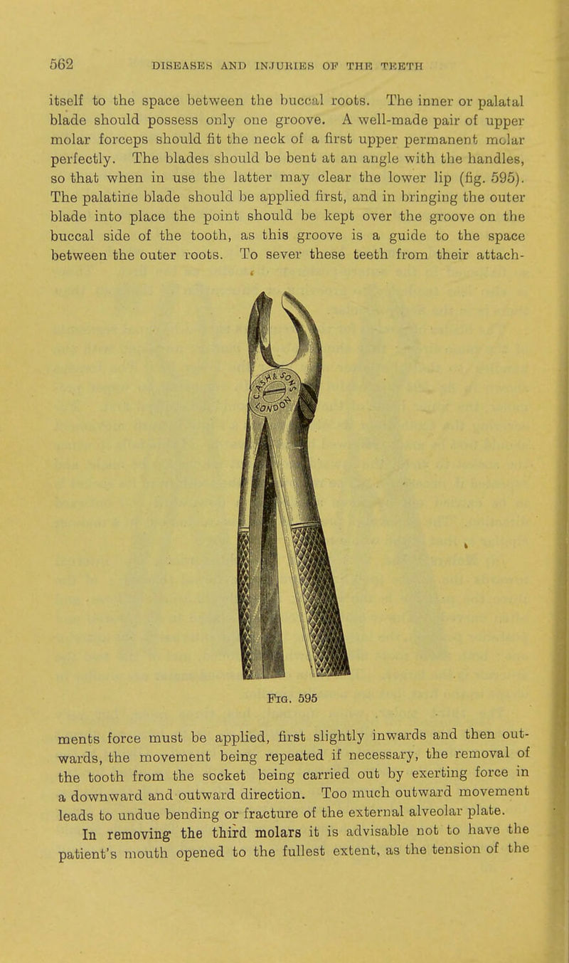 itself to the space between the buccal roots. The inner or palatal blade should possess only one groove. A well-made pair of upper molar forceps should fit the neck of a first upper permanent molar perfectly. The blades should be bent at an angle with the handles, so that when in use the latter may clear the lower lip (fig. 595). The palatine blade should be applied first, and in bringing the outer blade into place the point should be kept over the groove on the buccal side of the tooth, as this groove is a guide to the space between the outer roots. To sever these teeth from their attach- ments force must be apphed, first slightly inwards and then out- wards, the movement being repeated if necessary, the removal of the tooth from the socket being carried out by exerting force in a downward and outward direction. Too much outward movement leads to undue bending or fracture of the external alveolar plate. In removing the third molars it is advisable not to have the patient's mouth opened to the fullest extent, as the tension of the