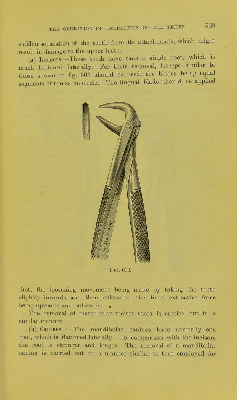 sudden separation of the tooth from its attachments, which might result in damage to the upper teeth. (a) Incisors—These teeth have each a single root, which is much flattened laterally. For their removal, forceps similar to those shown in fig. 603 should be used, the blades being equal segments of the same circle. The lingual blade should be apphed first, the loosening movement being made by taking the tooth slightly inwards and then outwards, the final extractive force being upwards and outwards. • The removal of mandibular incisor roots is carried out in a similar manner. (b) Canines. — The mandibular canines have normally one root, which is flattened laterally. In comparison with the incisors the root is stronger and longer. The removal of a mandibular canine is carried out in a manner similar to that employed for Pig. 603.