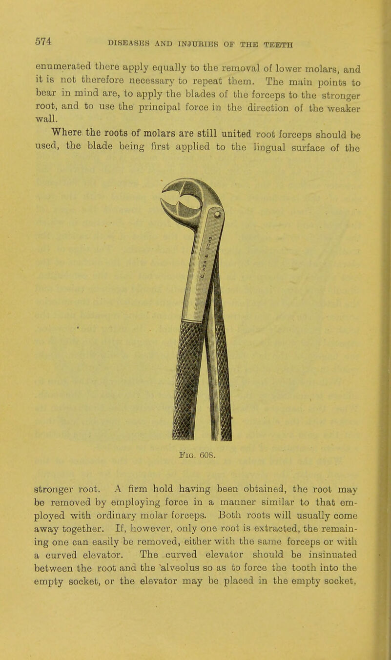 enumerated there apply equally to the removal of lower molars, and it is not therefore necessary to repeat them. The main points to bear in mind are, to apply the blades of the forceps to the stronger root, and to use the principal force in the direction of the weaker wall. Where the roots of molars are still united root forceps should be used, the blade being first applied to the lingual surface of the Pig. G08. stronger root. A firm hold having been obtained, the root may be removed by employing force in a manner similar to that em- ployed with ordinary molar forceps. Both roots will usually come away together. If, however, only one root is extracted, the remain- ing one can easily be removed, either with the same forceps or with a curved elevator. The curved elevator should be insinuated between the root and the 'alveolus so as to force the tooth into the empty socket, or the elevator may be placed in the empty socket,