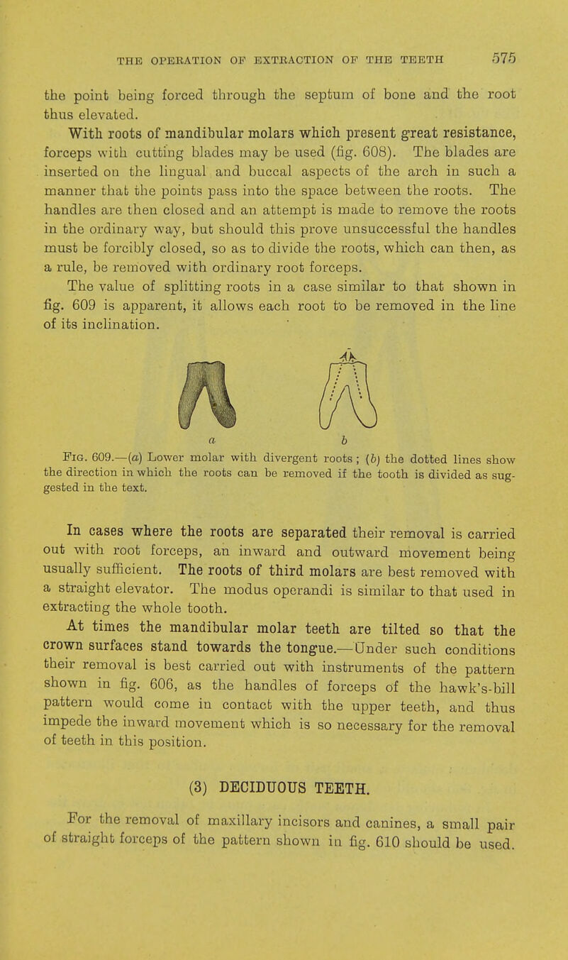 the point being forced through the septum of bone and the root thus elevated. With roots of mandibular molars which present great resistance, forceps with cutting blades may be used (iig. 608). The blades are inserted on the lingual and buccal aspects of the arch in such a manner that the points pass into the space between the roots. The handles are then closed and an attempt is made to remove the roots in the ordinary way, but should this prove unsuccessful the handles must be forcibly closed, so as to divide the roots, which can then, as a rule, be removed with ordinary root forceps. The value of splitting roots in a case similar to that shown in fig. 609 is apparent, it allows each root to be removed in the line of its inclination. a b Fig. 609.—(a) Lower molar with divergent roots ; (6j the dotted lines show the direction in which the roots can be removed if the tooth is divided as sug- gested in the text. In cases where the roots are separated their removal is carried out with root forceps, an inward and outward movement being usually sufficient. The roots of third molars are best removed with a straight elevator. The modus operandi is similar to that used in extracting the whole tooth. At times the mandibular molar teeth are tilted so that the crown surfaces stand towards the tongue.—Under such conditions their removal is best carried out with instruments of the pattern shown in fig. 606, as the handles of forceps of the hawk's-bill pattern would come in contact with the upper teeth, and thus impede the inward movement which is so necessary for the removal of teeth in this position. (3) DECIDUOUS TEETH. For the removal of maxillary incisors and canines, a small pair of straight forceps of the pattern shown in fig. 610 should be used.