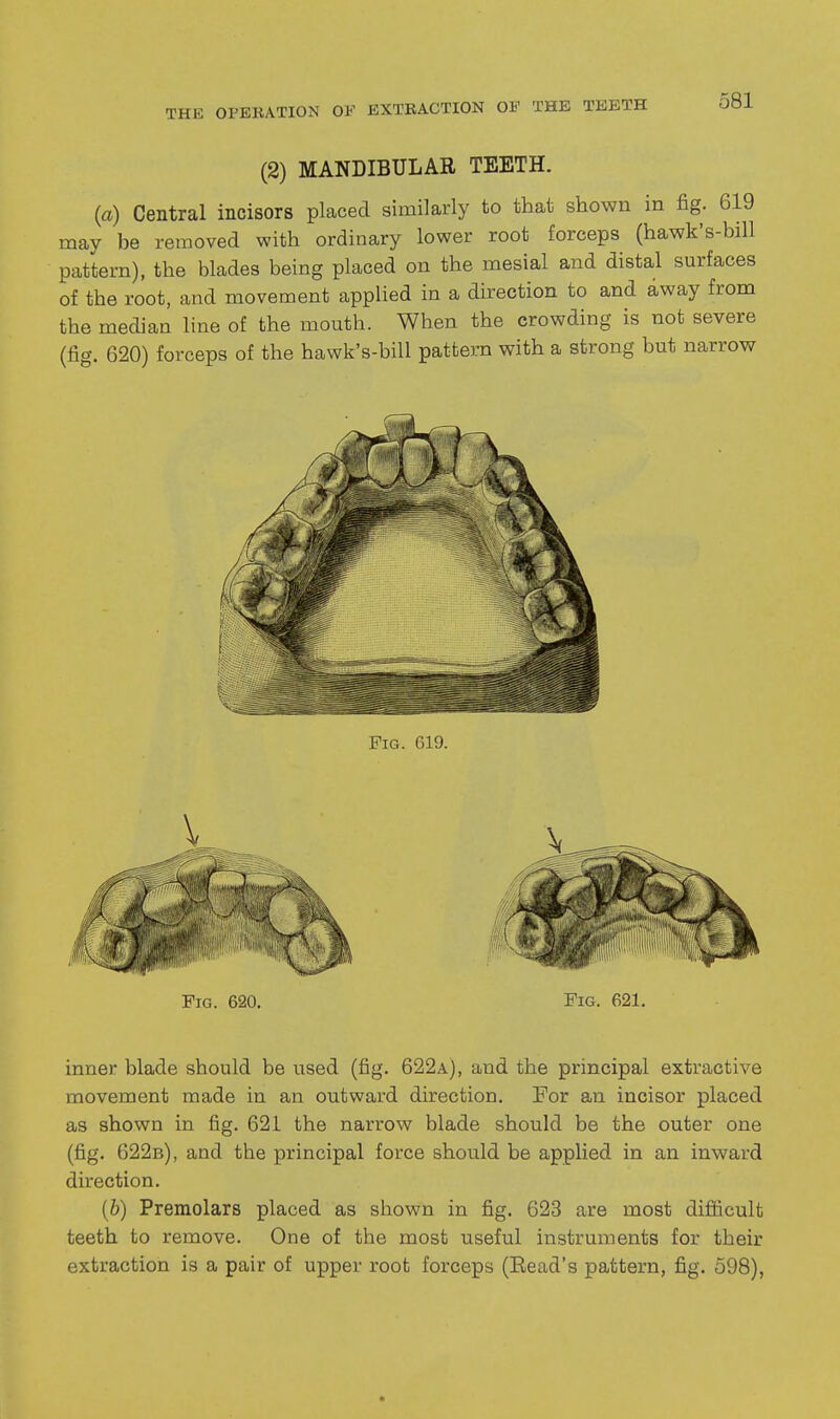 (2) MANDIBULAR TEETH. (a) Central incisors placed similarly to that shown in fig. 619 may be removed with ordinary lower root forceps (hawk's-bill pattern), the blades being placed on the mesial and distal surfaces of the root, and movement applied in a direction to and away from the median line of the mouth. When the crowding is not severe (fig. 620) forceps of the hawk's-bill pattern with a strong but narrow Fig. 019. inner blade should be vised (fig. 622a), and the principal extractive movement made in an outward direction. For an incisor placed as shown in fig. 621 the narrow blade should be the outer one (fig. 622b), and the principal force should be applied in an inward direction. (6) Premolars placed as shown in fig. 623 are most difficult teeth to remove. One of the most useful instruments for their extraction is a pair of upper root forceps (Bead's pattern, fig. 598),