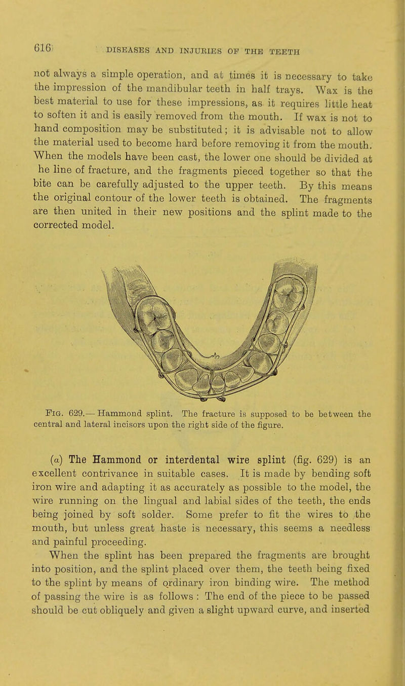 not always a simple operation, and at times it is necessary to take the impression of the mandibular teeth in half trays. Wax is the best material to use for these impressions, as it requires little heat to soften it and is easily removed from the mouth. If wax is not to hand composition may be substituted; it is advisable not to allow the material used to become hard before removing it from the mouth. When the models have been cast, the lower one should be divided at he line of fracture, and the fragments pieced together so that the bite can be carefully adjusted to the upper teeth. By this means the original contour of the lower teeth is obtained. The fragments are then united in their new positions and the splint made to the corrected model. Fig. 629.— Hammond splint. The fracture is supposed to be between the central and lateral incisors upon the right side of the figure. (a) The Hammond or interdental wire splint (fig. 629) is an excellent contrivance in suitable cases. It is made by bending soft iron wire and adapting it as accurately as possible to the model, the wire running on the lingual and labial sides of the teeth, the ends being joined by soft solder. Some prefer to fit the wires to the mouth, but unless great haste is necessary, this seems a needless and painful proceeding. When the splint has been prepared the fragments are brought into position, and the splint placed over them, the teeth being fixed to the splint by means of ordinary iron binding wire. The method of passing the wire is as follows : The end of the piece to be passed should be cut obliquely and given a slight upward curve, and inserted