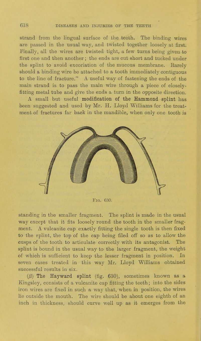 strand from the lingual surface of the teeth. The binding wires are passed in the usual way, and twisted together loosely at first. Finally, all the wires are twisted tight, a few turns being given to first one and then another; the ends are cut short and tucked under the splint to avoid excoriation of the mucous membrane. Earely should a binding wire be attached to a tooth immediately contiguous to the line of fracture. A useful way of fastening the ends of the main strand is to pass the main wire through a piece of closely- fitting metal tube and give the ends a turn in the opposite direction. A small but useful modification of the Hammond splint has been suggested and used by Mr. H. Lloyd Williams for the treat- ment of fractures far back in the mandible, when only one tooth is Fig. 630. standing in the smaller fragment. The splint is made in the usual way except that it fits loosely round the tooth in the smaller frag- ment. A vulcanite cap exactly fitting the single tooth is then fixed to the splint, the top of the cap being filed off so as to allow the cusps of the tooth to articulate correctly with its antagonist. The splint is bound in the usual way to the larger fragment, the weight of which is sufficient to keep the lesser fragment in position. In seven cases treated in this way Mr. Lloyd Williams obtained successful results in six. The Hay ward splint (fig. 630), sometimes known as a Kingsley, consists of a vulcanite cap fitting the teeth; into the sides iron wires are fixed in such a way that, when in position, the wires lie oixtside the mouth. The wire should be about one eighth of an inch in thickness, should curve well up as it emerges from the