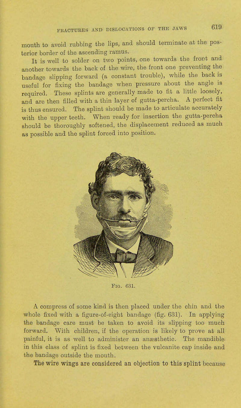 mouth to avoid rubbing the Hps, and should terminate at the pos- terior border of the ascending ramus. It is well to solder on two points, one towards the front and another towards the back of the wire, the front one preventing the bandage sHpping forward (a constant trouble), while the back is useful for fixing the bandage when pressure about the angle is required. These splints are generally made to fit a little loosely, and are then filled with a thin layer of gutta-percha. A perfect fit is thus ensured. The splint should be made to articulate accurately with the upper teeth. When ready for insertion the gutta-percha should be thoroughly softened, the displacement reduced as much as possible and the splint forced into position. Fig. 631. A compress of some kind is then placed under the chin and the whole fixed with a figure-of-eight bandage (fig. 631). In applying the bandage care must be taken to avoid its slipping too much forward. With children, if the operation is likely to prove at all painful, it is as well to administer an anaesthetic. The mandible in this class of splint is fixed between the vulcanite cap inside and the bandage outside the mouth. The wire wings are considered an objection to this splint because